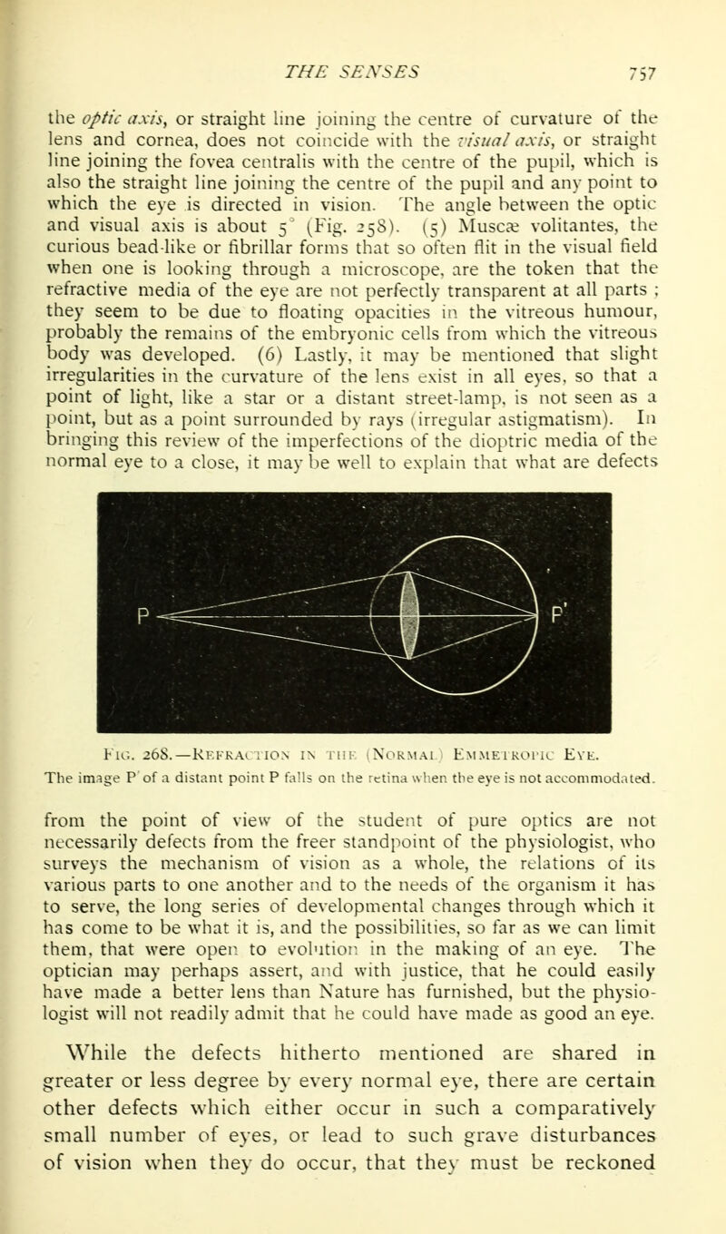 the optic ax/s, or straight line joining the centre of curvature of the lens and cornea, does not coincide with the risua/ axis, or straight line joining the fovea centralis with the centre of the pupil, which is also the straight line joining the centre of the pupil and any point to which the eye is directed in vision. The angle between the optic and visual axis is about 5 (Fig. 258). (5) Muscle volitantes, the curious bead-like or fibrillar forms that so often flit in the visual field when one is looking through a microscope, are the token that the refractive media of the eye are not perfectly transparent at all parts ; they seem to be due to floating opacities m the vitreous humour, probably the remains of the embryonic cells from which the vitreou.^ body was developed. (6) Lastly, it may be mentioned that slight irregularities in the curvature of the lens exist in all eyes, so that a point of light, like a star or a distant street-lamp, is not seen as a point, but as a point surrounded by rays (^irregular astigmatism). In bringing this review of the imperfections of the dioptric media of the normal eye to a close, it may lie well to explain that what are defects I'lC. 20S.—KkKKAi IIO.N IN lliF iNORM.-Vl EM.MElROl'iC EVE. Tlie im.^ge P of a distant point P tails on the retina wlien the eye is not accommodated. from the point of view of the studer.t of pure optics are not necessarily defects from the freer standj^oint of the physiologist, who surveys the mechanism of vision as a whole, the relations of its various parts to one another and to the needs of the organism it has to serve, the long series of developmental changes through which it has come to be what it is, and the possibilities, so far as we can limit them, that were open to evolution in the making of an eye. I'he optician may perhaps assert, and with justice, that he could easily have made a better lens than Nature has furnished, but the physio- logist will not readily admit that he could have made as good an eye. While the defects hitherto mentioned are shared in greater or less degree by every normal eye, there are certain other defects which either occtir in such a comparatively small number of eyes, or lead to such grave disturbances of vision when the\' do occur, that the\ must be reckoned