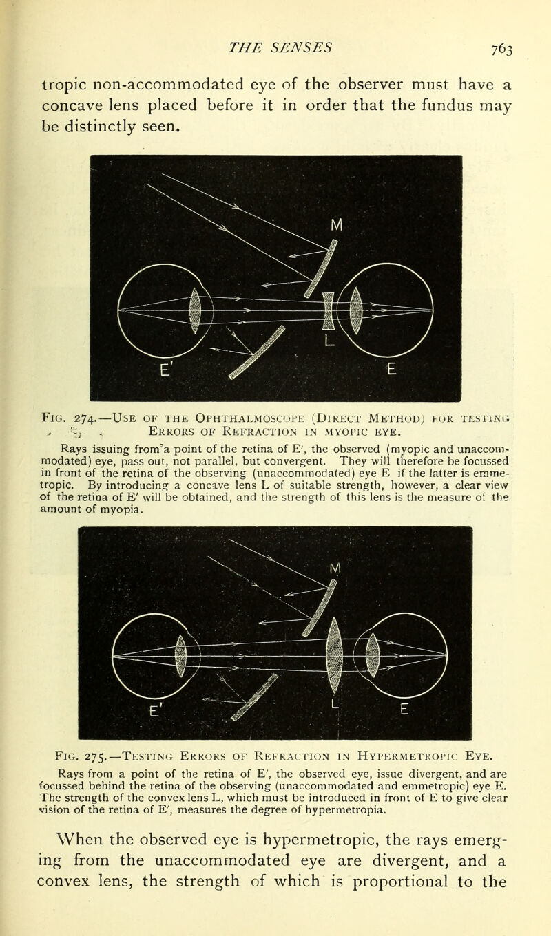 tropic non-accommodated eye of the observer must have a concave lens placed before it in order that the fundus may be distinctly seen. Fig. 274.—Use of the Ophthalmoscope (Direct Method; for testiing '•'^y .. Errors of Refraction in myopic eye. Rays issuing from'a point of the retina of E', the observed (myopic and unaccom- modated) eye, pass out, not parallel, but convergent. They will therefore be focussed in front of the retina of the observing (unaccommodated) eye E if the latter is emme- tropic. By introducing a concave lens L of suitable strength, however, a clear view of the retina of E' will be obtained, and the strength of this lens is the measure of the amount of myopia. Fig. 275.—Testing Errors of Refraction in Hypermetropic Eye. Rays from a point of the retina of E', the observed eye, issue divergent, and are focussed behind the retina of the observing (unaccommodated and emmetropic) eye E. The strength of the convex lens L, which must be introduced in front of 1^ to give clear vision of the retina of E', measures the degree of hypermetropia. When the observed eye is hypermetropic, the rays emerg- ing from the unaccommodated eye are divergent, and a convex lens, the strength of which is proportional to the