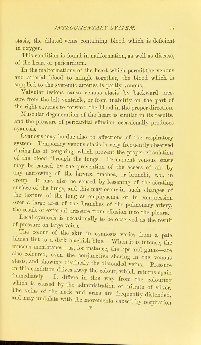 stasis, the dilated veins containing blood which, is deficient in oxygen. This condition is found in malformation, as well as disease, of the heart or pericardium. In the malformations of the heart which permit the venous and arterial blood to mingle together, the blood which is supplied to the systemic arteries is partly venous. Valvular lesions cause venous stasis by backward pres- sure from the left ventricle, or from inability on the part of the right cavities to forward the blood in the proper direction. Muscular degeneration of the heart is similar in its results, and the pressure of pericardial effusion occasionally produces cyanosis. Cyanosis may be due also to affections of the respiratory system. Temporary venous stasis is very frequently observed during fits of coughing, which prevent the proper circulation of the blood through the lungs. Permanent venous stasis may be caused by the prevention of the access of air by any narrowing of the larynx, trachea, or bronchi, e.g., in croup. It may also be caused by lessening of the aerating surface of the lungs, and this may occur in such changes of the texture of the lung as emphysema, or in compression over a large area of the branches of the pulmonary artery, the residt of external pressure from effusion into the pleura. Local cyanosis is occasionally to be observed as the result of pressure on large veins. The colour of the skin in cyanosis varies from a pale bluish tint to a dark blackish blue. When it is intense, the mucous membranes-as, for instance, the lips and gums—are also coloured, even the conjunctiva sharing in the venous stasis, and showing distinctly the distended veins. Pressure m this condition drives away the colour, which returns again immediately. It differs in this way from the colouring which is caused by the administration of nitrate of silver The veins o the neck and arms are frequently distended, and may undulate with the movements caused by respiration 13