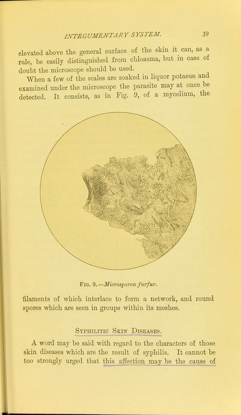 elevated above the general surface of the skin it can, as a rule, be easily distinguished from chloasma, but m case of doubt the microscope should be used. When a few of the scales are soaked in liquor potassjs and examined under the microscope the parasite may at once be detected. It consists, as in Fig. 9, of a mycelium, the Fig. 9.—Microsporon furfur. filaments of which interlace to form a network, and round spores which are seen in groups within its meshes. Syphilitic Skin Diseases. A word may be said with regard to the characters of those skin diseases which are the result of syphilis. It cannot be too strongly urged that this j^ection_ may be the cause of