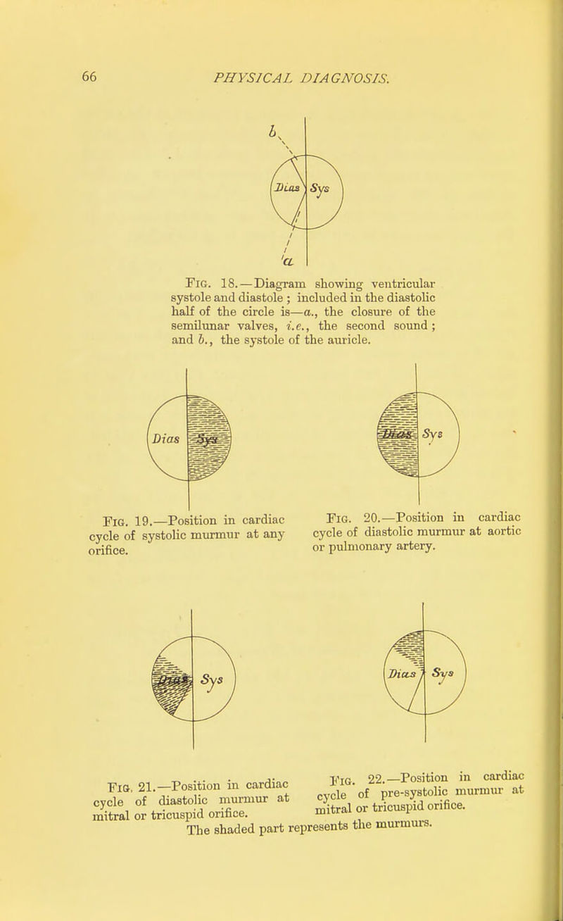 K i i a Fig. 18.—Diagram showing ventricular systole and diastole ; included in the diastolic half of the circle is—a., the closure of the semilunar valves, i.e., the second sound; and b., the systole of the auricle. Fig. 19.—Position in cardiac cycle of systolic murmur at any orifice. Fig. 20.—Position in cardiac cycle of diastolic murmur at aortic or pulmonary artery. ^ ... . j- Vtc 22.—Position in cardiac Fig, 21.-Posmon m cardiac 1w. ^ afc cycle of diastolic murmur at cjcle ot P ? mitral or tricuspid orifice. mitrai or wu-uoy The shaded part represents the murmurs.
