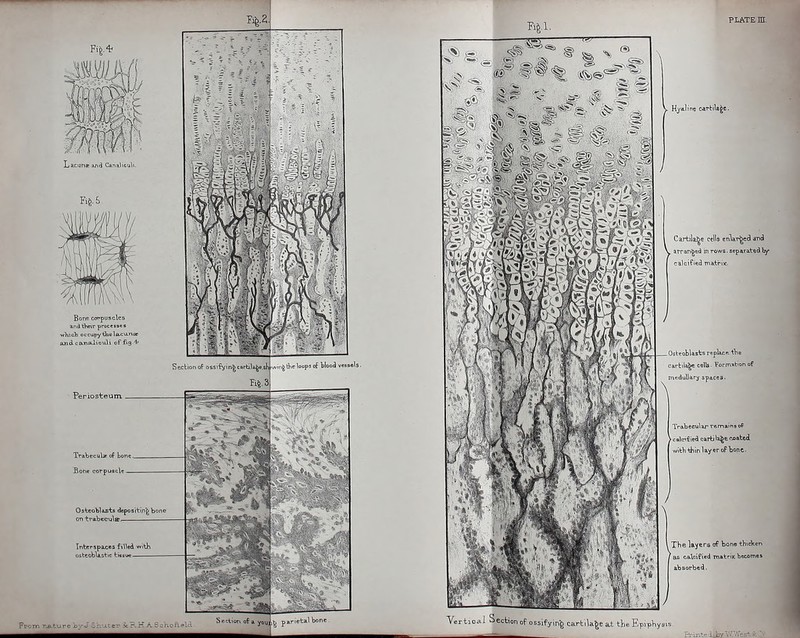 ® tit. i^^S *3 y Hyaline cartilage. Cartili^e cells enlar^ecl and . arranged in rows, sepavatad calcified matrix- _ Osteoblasts replacp- 'the rbik^ celb. Formation of medullary spa.cea- Tra.becxiW ramnins oP calcified cartila^t coated with thin lay er of bone. YerticAl Section of ossifying cartilage at the E The layers of bono thicVen as calcified matrix becomes absorbed.