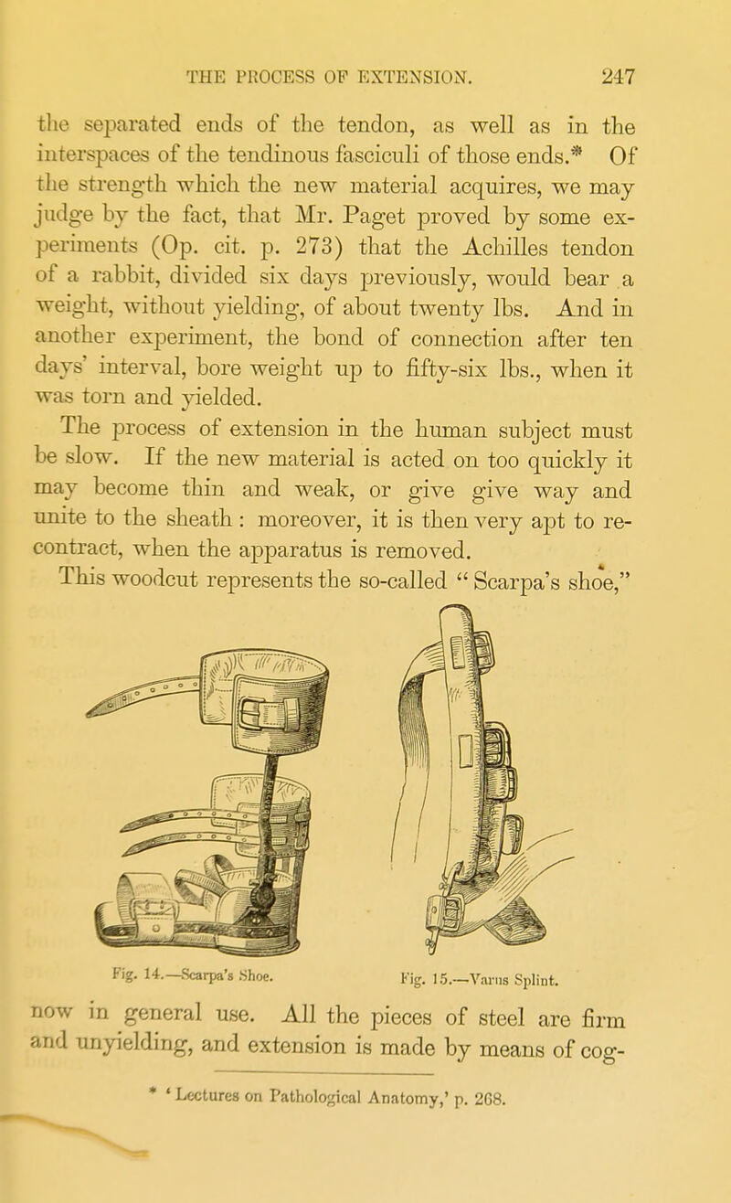 the separated ends of the tendon, as well as in the interspaces of the tendinous fasciculi of those ends.* Of the strength which the new material acquires, we may judge by the fact, that Mr. Paget proved by some ex- periments (Op. cit. p. 273) that the Achilles tendon of a rabbit, divided six days previously, would bear a weight, without yielding, of about twenty lbs. And in another experiment, the bond of connection after ten days' interval, bore weight up to fifty-six lbs., when it was torn and yielded. The process of extension in the human subject must be slow. If the new material is acted on too quickly it may become thin and weak, or give give way and unite to the sheath : moreover, it is then very apt to re- contract, when the apparatus is removed. This woodcut represents the so-called  Scarpa's shoe, Fig. 14.—Scarpa's Shoe. Fig. 15.—Varus Splint. now in general use. All the pieces of steel are firm and unyielding, and extension is made by means of cog- * ' Lectures on Pathological Anatomy,' p. 268.