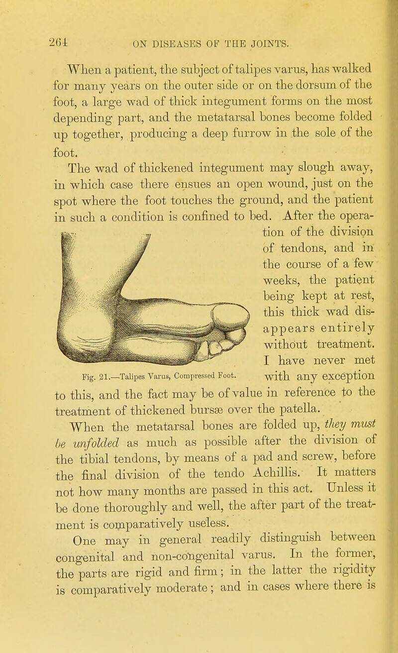 When a patient, the subject of talipes varus, has walked for many years on the outer side or on the dorsum of the foot, a large wad of thick integument forms on the most depending part, and the metatarsal bones become folded up together, producing a deep furrow in the sole of the foot. The wad of thickened integument may slough away, iu which case there ensues an open wound, just on the spot where the foot touches the ground, and the patient in such a condition is confined to bed. After the opera- tion of the division of tendons, and in the course of a few weeks, the patient being kept at rest, this thick wad dis- appears entirely without treatment. I have never met Fig. 21.—Talipes Varus, Compressed Foot. with any exception to this, and the fact may be of value in reference to the treatment of thickened bursa? over the patella. When the metatarsal bones are folded up, they must be unfolded as much as possible after the division of the tibial tendons, by means of a pad and screw, before the final division of the tendo Achillas. It matters not how many months are passed in this act. Unless it be done thoroughly and well, the after part of the treat- ment is comparatively useless. One may in general readily distinguish between congenital and non-congenital varus. In the former, the parts are rigid and firm; in the latter the rigidity is comparatively moderate; and in cases where there is