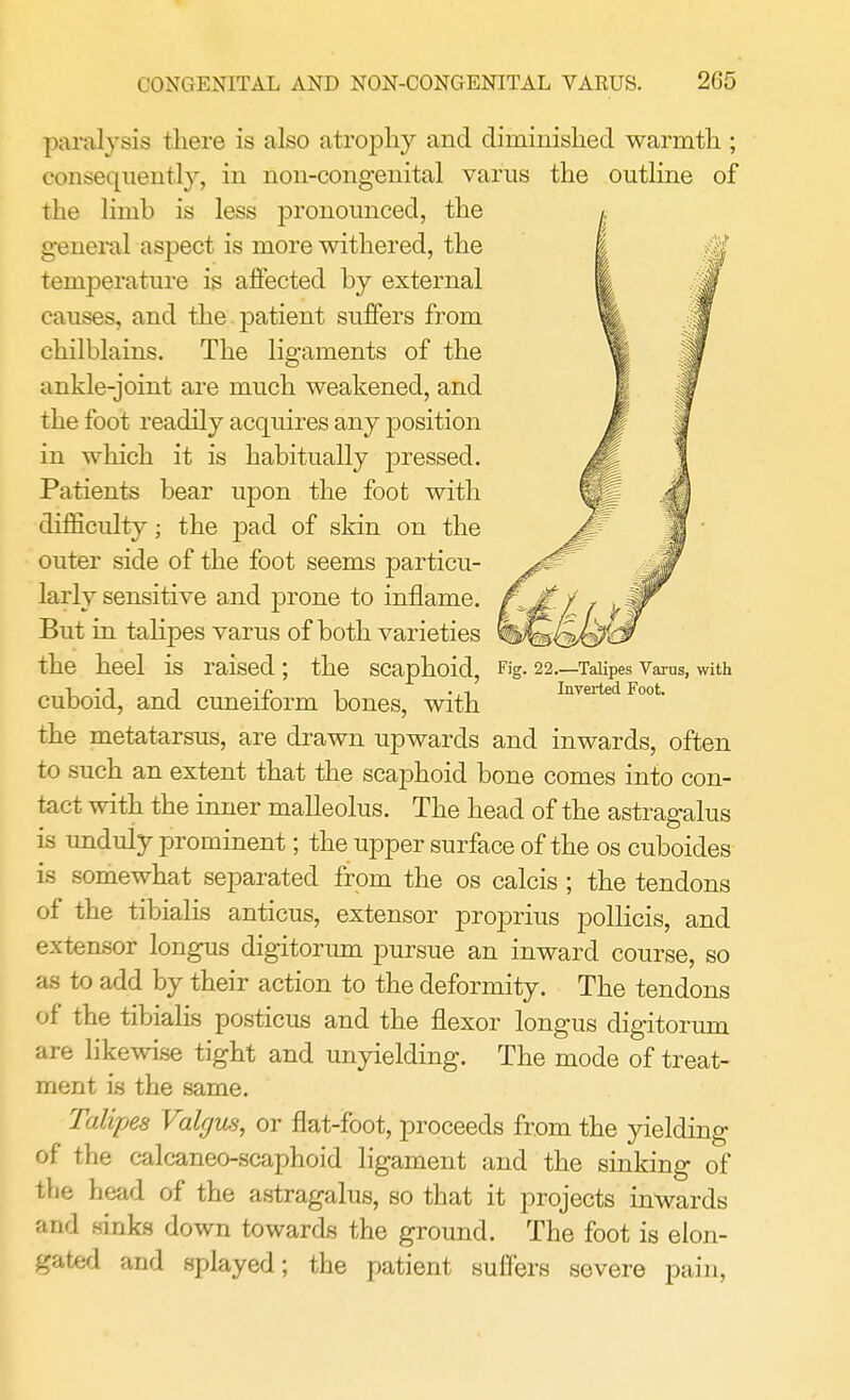 paralysis there is also atrophy and diminished warmth ; consequently, in non-congenital varus the outline of the limb is less pronounced, the general aspect is more withered, the temperature is affected by external causes, and the patient suffers from chilblains. The ligaments of the ankle-joint are much weakened, and the foot readily acquires any position in which it is habitually pressed. Patients bear upon the foot with difficulty; the pad of skin on the outer side of the foot seems particu- larly sensitive and prone to inflame. But in talipes varus of both varieties the heel is raised ; the scaphoid, Fig- 22—Talipes Varus, with 1 • i n •« ■■ .,, Inverted Foot. cuboid, and cuneiform bones, with the metatarsus, are drawn upwards and inwards, often to such an extent that the scaphoid bone comes into con- tact with the inner malleolus. The head of the astragalus is unduly prominent; the upper surface of the os cuboides is somewhat separated from the os calcis ; the tendons of the tibialis anticus, extensor proprius pollicis, and extensor longus digitorum pursue an inward course, so as to add by their action to the deformity. The tendons of the tibialis posticus and the flexor longus digitorum are likewise tight and unyielding. The mode of treat- ment is the same. Talipes Valgus, or flat-foot, proceeds from the yielding of the calcaneo-scaphoid ligament and the sinking of the head of the astragalus, so that it projects inwards and sinks down towards the ground. The foot is elon- gated and splayed; the patient suffers severe pain,