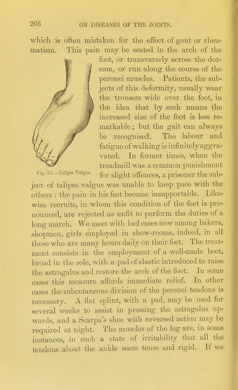 2G6 which is often mistaken for the effect of gout or rheu- matism. This pain may be seated in the arch of the foot, or transversely across the dor- sum, or run along the course of the peronei muscles. Patients, the sub- jects of this deformity, usually wear the trousers wide over the foot, in the idea that by such means the increased size of the foot is less re- markable ; but the gait can always be recognised. The labour and fatigue of walking is infinitely aggra- vated. In former times, when the treadmill was a common punishment Fig. 23—Taiipes Valgus. for offences? a prisoner the sub- ject of talipes valgus was unable to keep pace with the others : the pain in his feet became insupportable. Like- wise recruits, in whom this condition of the feet is pro- nounced, are rejected as unfit to perform the duties of a long march. We meet with bad cases now among bakers, shopmen, girls employed in show-rooms, indeed, in all those who are many hours daily on their feet. The treat- ment consists in the employment of a well-made boot, broad in the sole, with a pad of elastic introduced to raise the astragalus and restore the arch of the foot. In some cases this measure affords immediate relief. In other cases the subcutaneous division of the peronei tendons is necessary. A flat splint, with a pad, may be used for several weeks to assist in pressing the astragalus up- wards, and a Scarpa's shoe with reversed action may be required at night. The muscles of the leg are, in some instances, in such a state of irritability that all the tendons about the ankle seem tense and rigid. If we
