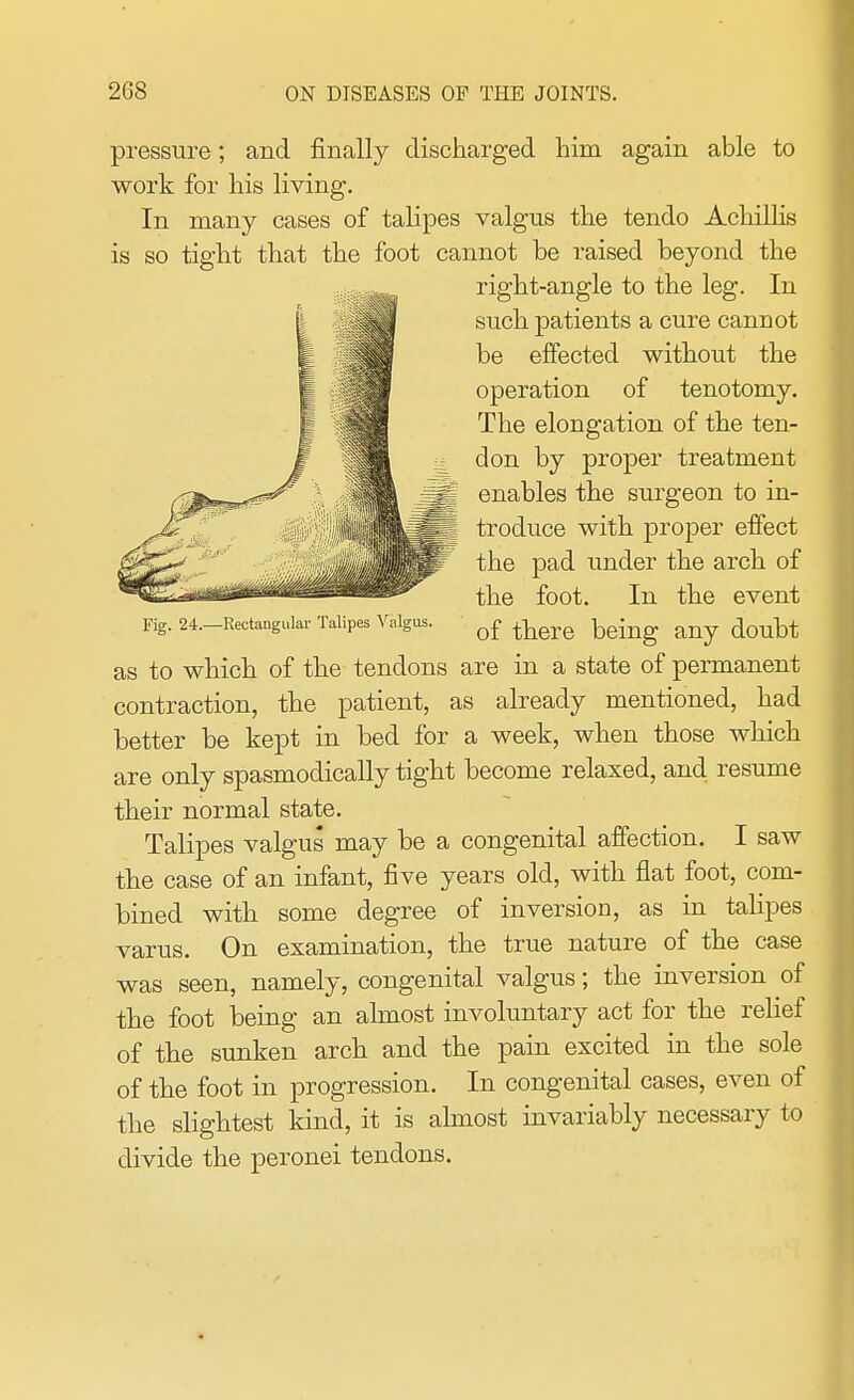 pressure; and finally discharged him again able to work for his living. In many cases of talipes valgus the tendo Achillis is so tight that the foot cannot be raised beyond the right-angle to the leg. In such patients a cure cannot be effected without the operation of tenotomy. The elongation of the ten- don by proper treatment enables the surgeon to in- troduce with proper effect the pad under the arch of the foot. In the event Fig. 24—Hectangular Talipes Valgus. of ^ dcmbt as to which of the tendons are in a state of permanent contraction, the patient, as already mentioned, had better be kept in bed for a week, when those which are only spasmodically tight become relaxed, and resume their normal state. Talipes valgus may be a congenital affection. I saw the case of an infant, five years old, with fiat foot, com- bined with some degree of inversion, as in talipes varus. On examination, the true nature of the case was seen, namely, congenital valgus; the inversion of the foot being an almost involuntary act for the relief of the sunken arch and the pain excited in the sole of the foot in progression. In congenital cases, even of the slightest kind, it is almost invariably necessary to divide the peronei tendons.
