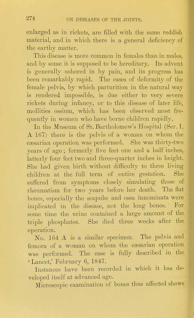 enlarged as in rickets, are filled with the same reddish material, and in which there is a general deficiency of the earthy matter. This disease is more common in females than in males, and by some it is supposed to be hereditary. Its advent is generally ushered in by pain, and its progress has been remarkably rapid. The cases of deformity of the female pelvis, by which parturition in the natural way is rendered impossible, is due either to very severe rickets during infancy, or to this disease of later life, mollities ossium, which has been observed most fre- quently in women who have borne children rapidly. In the Museum of St. Bartholomew's Hospital (Ser. I. A 167) there is the pelvis of a woman on whom the cassarian operation was performed. She was thirty-two years of age; formerly five feet one and a half inches, latterly four feet two and three-quarter inches in height. She had given birth without difficulty to three living- children at the full term of entire gestation. She suffered from symptoms closely simulating those of rheumatism for two years before her death. The flat bones, especially the scapulas and ossa innominata were implicated in the disease, not the long bones. ' For some time the urine contained a large amount of the triple phosphates. She died three weeks after the operation. No. 164 A is a similar specimen. The pelvis and femora of a woman on whom the cassarian operation was performed. The case is fully described in the ' Lancet,' February 6, 1847. Instances have been recorded in which it has de- veloped itself at advanced age. Microscopic examination of bones thus affected shows