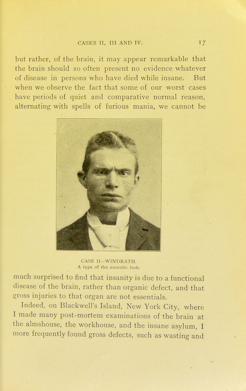 but rather, of the brain, it may appear remarkable that the brain should so often present no evidence whatever of disease in persons who have died while insane. But when we observe the fact that some of our worst cases have periods of quiet and comparative normal reason, alternating with spells of furious mania, we cannot be CASE II—WINDRATH. A type of the neurotic look. much surprised to find that insanity is due to a functional disease of the brain, rather than organic defect, and that gross injuries to that organ are not essentials. Indeed, on Blackwell's Island, New York City, where I made many post-mortem examinations of the brain at the almshouse, the workhouse, and the insane asylum, I more frequently found gross defects, such as wasting and