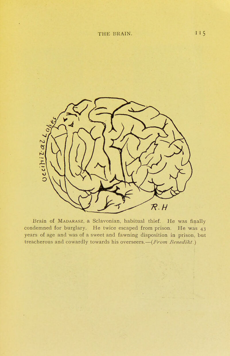 Brain of Madarasz, a Sclavonian, habitual thief. He was finally condemned for burglary. He twice escaped from prison. He was 43 years of age and was of a sweet and fawning disposition in prison, but treacherous and cowardly towards his overseers.—(From Benedikt.)