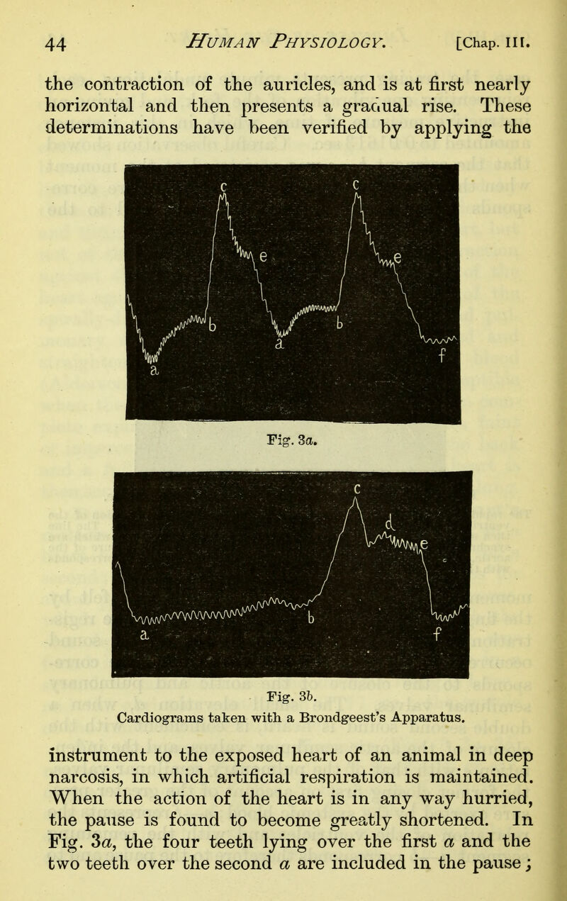 the contraction of the auricles, and is at first nearly horizontal and then presents a graciual rise. These determinations have been verified by applying the Fi^. 3a. c Ad ■ \ J a f Fig. 3b. Cardiograms taken with a Broin igeest's Apparatus. instrument to the exposed heart of an animal in deep narcosis, in which artificial respiration is maintained. When the action of the heart is in any way hurried, the pause is found to become greatly shortened. In Fig. 3a, the four teeth lying over the first a and the two teeth over the second a are included in the pause;