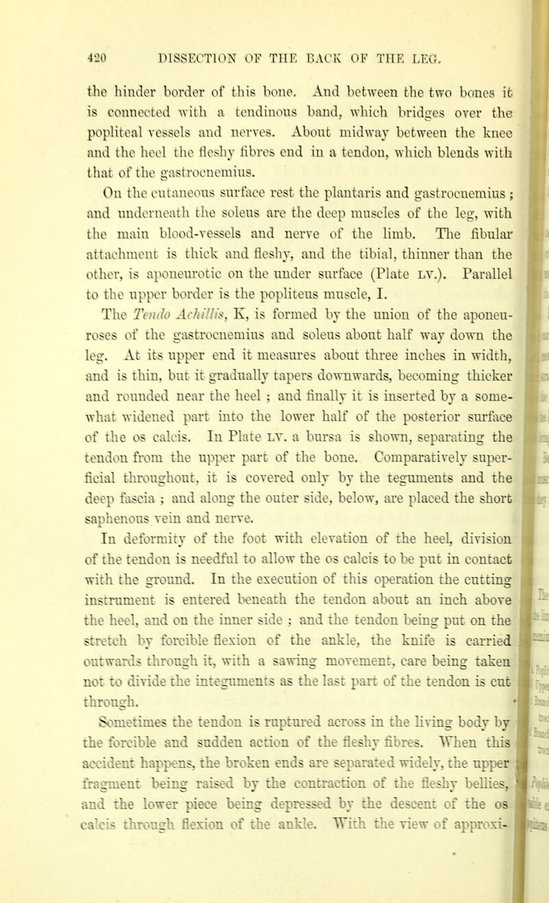 niSSKA'TlON OV Till, r.AC'K C'F TITK LF.O, tlio liiiulor border of this bone. Ami between the two bones it is eoniioeted witli a tendinous band, wliieli bridges over the popliteal vessels and nerves. About midway between the knee and the heel tl\e tleshy libres end in a tendon, whieh blends with that of the g;istroeneiniu^. On the eutaneous surtaee rest the plantaris and gastrocnemius ; and underneath the solens are the dee}i nuiseles of the leg, with the main blood-vessels and nerve of the limb. Tlie fibnlar attaehmettt is thiek and tleshy. and the tibial, thinner than the other, is aponeurotie on the under surtaee iriate lx.). Pai-allel to tb.e npper border is the pojiliteus musele. I. The Teiido Achillu^. K. is formed by the union of the aponeu- roses of the g-astroeneinius and solens about half way down the leg. At its upper end it measures about three inehes in width, atid is thin, but it gradually tapers downwards, beeoming thicker and rounded near the heel : and finally it is inserted by a some- what widened part into the lower half of the posterior surface of the OS eah-is. In Plato i.v, a bursa is shown, separating the tendon from the upper part of the bone. Comparatively super- hcitil throughout, it is covered only by the tegtmients and the deep fascia ; and along the outer side, below, are placed the short saphenous vein and nerve. In deformity of the foot with elevation of the heel division of the tendon is needful to allow the os calcis to be put in contact with [he ground. In the execution of this operation the cutting instrument is entered beneath the tendon about an inch above the heel, and on the inner side : and the tendon being put on the stretch by forcible flexion of the ankle, the knife is carried outwards through it, with a sawing movement, care being taken not to divide the integuments as the last part of the tendon is cut through. Sometimes the tendon is rnptm-ed across in the living body by the forcible and sudden action of the fleshy fibres. When this accident happens, the broken ends are separated widely, the upj)er fragment being raised by the contraction of the fleshy bellies, and the lower piece being depressed by the descent of the os calcis through flexion of the ankle. With the riew of approxi-