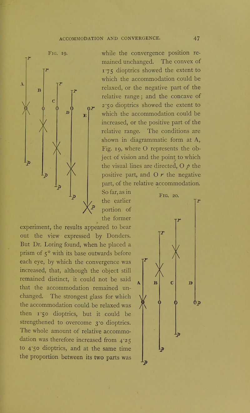 Fig. 19. J3 X» Q) /\ or while the convergence position re- mained unchanged. The convex of 175 dioptrics showed the extent to which the accommodation could be relaxed, or the negative part of the relative range; and the concave of 2*50 dioptrics showed the extent to which the accommodation could be increased, or the positive part of the relative range. The conditions are shown in diagrammatic form at A, Fig. 19, where O represents the ob- ject of vision and the point to which the visual lines are directed, 0 p the positive part, and O r the negative part, of the relative accommodation. So far, as in the earlier portion of the former experiment, the results appeared to bear out the view expressed by Bonders. But Dr. Loring found, when he placed a prism of 5° with its base outwards before each eye, by which the convergence was increased, that, although the object still remained distinct, it could not be said that the accommodation remained un- changed. The strongest glass for which the accommodation could be relaxed was then 1-50 dioptrics, but it could be strengthened to overcome yo dioptrics. The whole amount of relative accommo- dation was therefore increased from 4-25 to 4-50 dioptrics, and at the same time the proportion between its two parts was Fig. 20. 0 6i>