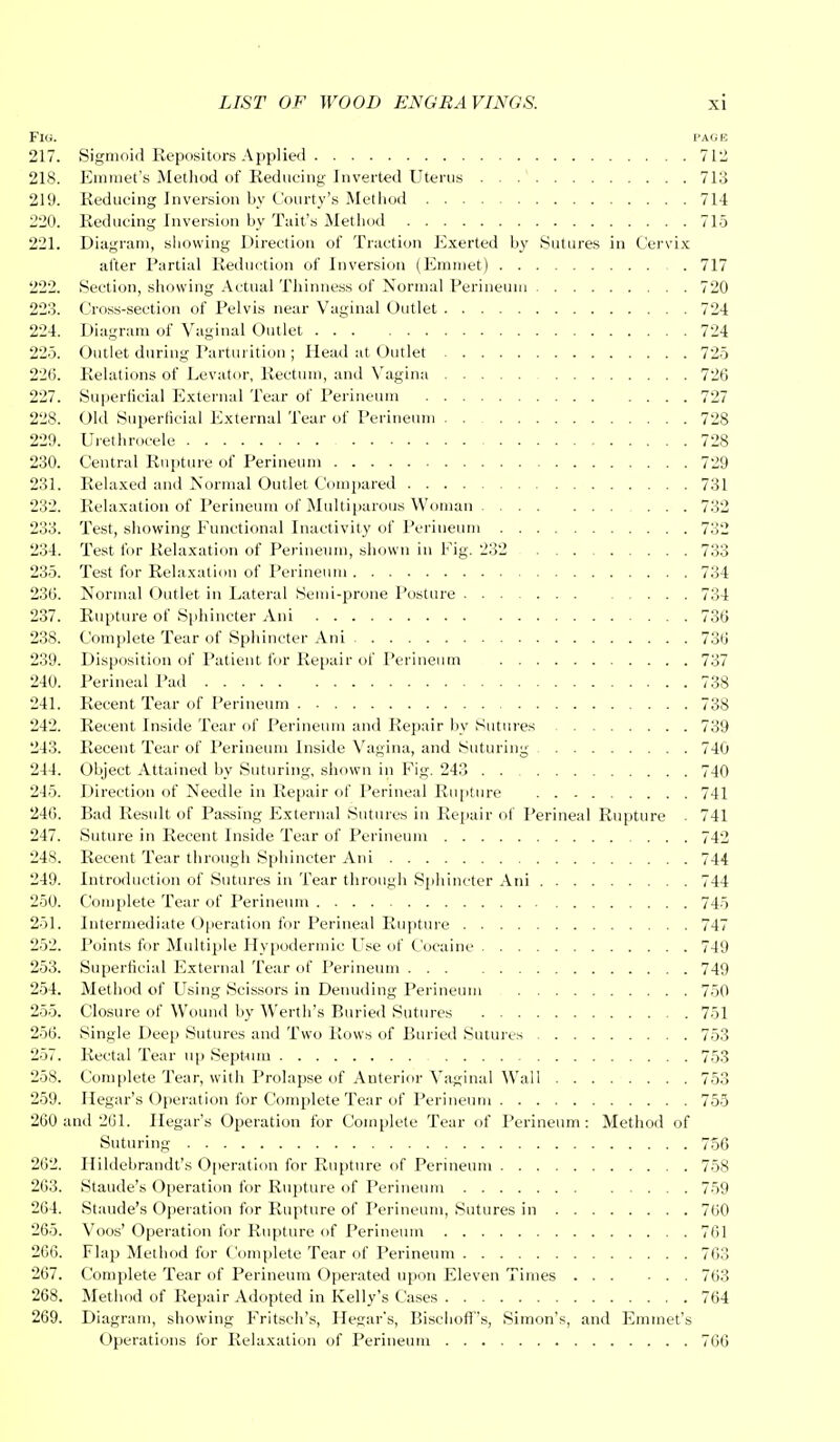 Fig. page 217. Sigmoid Repositors Applied 71.! 218. Emmet's Method of Reducing Inverted Uterus . . .' 713 219. Reducing Inversion by Courty's Method 714 220. Reducing Inversion by Tail's Method 715 221. Diagram, showing Direction of Traction Exerted by Sutures in Cervix after Partial Reduction of Inversion (Emmet) 717 222. Section, showing Actual Thinness of Normal Perineum 720 223. Cross-section of Pelvis near Vaginal Outlet 724 224. Diagram of Vaginal Outlet 724 225. Outlet during Parturition ; Head at Outlet 725 220. Relations of Levator, Rectum, and Vagina 726 227. Superficial External Tear of Perineum 727 228. Old Superficial External Tear of Perineum 728 229. Urethrocele 728 230. Central Rupture of Perineum 729 231. Relaxed and Normal Outlet Compared 731 232. Relaxation of Perineum of Multiparous Woman 732 233. Test, showing Functional Inactivity of Perineum 732 234. Test for Relaxation of Perineum, shown in Fig. 232 733 235. Test for Relaxation of Perineum 734 230. Normal Outlet in Lateral Semi-prone Posture 734 237. Rupture of Sphincter Ani 730 238. Complete Tear of Sphincter Ani 730 239. Disposition of Patient for Repair of Perineum 737 240. Perineal Pad 738 241. Recent Tear of Perineum 738 242. Recent Inside Tear of Perineum and Repair by Sutures 739 243. Recent Tear of Perineum Inside Vagina, and Suturing 740 244. Object Attained by Suturing, shown in Fig. 243 740 245. Direction of Needle in Repair of Perineal Rupture 741 246. Bad Result of Passing External Sutures in Repair of Perineal Rupture - 741 247. Suture in Recent Inside Tear of Perineum 742 248. Recent Tear through Sphincter Ani 744 249. Introduction of Sutures in Tear through Sphincter Ani 744 250. Complete Tear of Perineum 745 251. Intermediate Operation for Perineal Rupture 747 252. Points for Multiple Hypodermic Use of Cocaine 749 253. Superficial External Tear of Perineum 749 254. Method of Using Scissors in Denuding Perineum 750 255. Closure of Wound by Werth's Buried Sutures 751 256. Single Deep Sutures and Two Rows of Buried Sutures 753 257. Rectal Tear up Septum 753 258. Complete Tear, with Prolapse of Anterior Vaginal Wall 753 259. Hegar's Operation for Complete Tear of Perineum 755 200 and 201. Hegar's Operation for Complete Tear of Perineum: Method of Suturing 756 202. Hildebrandt's Operation for Rupture of Perineum 758 203. Staude's Operation for Rupture of Perineum 759 204. Staude's Operation for Rupture of Perineum, Sutures in 700 265. Voos' Operation for Rupture of Perineum 761 266. Flap Method for Complete Tear of Perineum 763 267. Complete Tear of Perineum Operated upon Eleven Times 763 268. Method of Repair Adopted in Kelly's Cases 764 269. Diagram, showing Fritsch's, Hegar's, Bischoff's, Simon's, and Emmet's Operations for Relaxation of Perineum 766