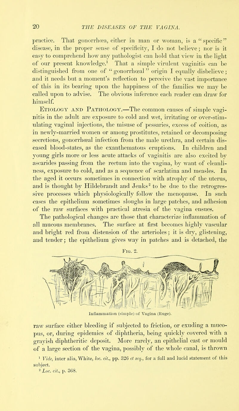 practice. That gonorrhoea, either in man or woman, is a  specific disease, in the proper sense of specificity, I do not believe; nor is it easy to comprehend how any pathologist can hold that view in the light of our present knowledge.1 That a simple virulent vaginitis can be distinguished from one of  gonorrheal origin I equally disbelieve; and it needs but a moment's reflection to perceive the vast importance of this in its bearing upon the happiness of the families we may be called upon to advise. The obvious inference each reader can draw for himself. Etiology and Pathology.—The common causes of simple vagi- nitis in the adult are exposure to cold and wet, irritating or over-stim- ulating vaginal injections, the misuse of pessaries, excess of coition, as in newly-married women or among prostitutes, retained or decomposing secretions, gonorrheal infection from the male urethra, and certain dis- eased blood-states, as the exanthematous eruptions. In children and young girls more or less acute attacks of vaginitis are also excited by ascarides passing from the rectum into the vagina, by want of cleanli- ness, exposure to cold, and as a sequence of scarlatina and measles. In the aged it occurs sometimes in connection with atrophy of the uterus, and is thought by Hildebrandt and Jenks2 to be due to the retrogres- sive processes which physiologically follow the menopause. In such cases the epithelium sometimes sloughs in large patches, and adhesion of the raw surfaces with practical atresia of the vagina ensues. The pathological changes are those that characterize inflammation of all mucous membranes. The surface at first becomes highly vascular and bright red from distension of the arterioles; it is dry, glistening, and tender; the epithelium gives way in patches and is detached, the Fig. 2. Inflammation (simple) of Vagina (Ruge). raw surface either bleeding if subjected to friction, or exuding a muco- pus, or, during epidemics of diphtheria, being quickly covered with a grayish diphtheritic deposit. More rarely, an epithelial cast or mould of a large section of the vagina, possibly of the whole canal, is thrown 1 Vide, inter alia, White, foe. cit., pp. 326 et seq., for a full and lucid statement of this subject. 2 Luc. cit., p. 368.