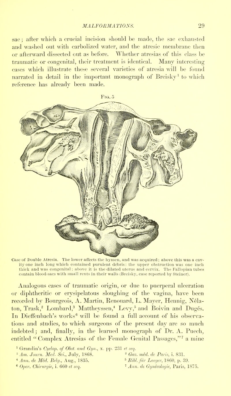 sac; after which a crucial incision should he made, the sac exhausted and washed out with carbolized water, and the atresic membrane then or afterward dissected out as before. Whether atresias of this class be traumatic or congenital, their treatment is identical. Many interesting cases which illustrate these several varieties of atresia will be found narrated in detail in the important monograph of Breisky1 to which reference has already been made. Fig. 5 Case of Double Atresia. The lower affects the hymen, and was acquired; above this was a cav- ity one inch long which contained purulent debris: the upper obstruction was one inch thick and was congenital: above it is the dilated uterus and cervix. The Fallopian tubes contain blood-sacs with small rents in their walls (Breisky, case reported by Steiner). Analogous cases of traumatic origin, or due to puerperal ulceration or diphtheritic or erysipelatous sloughing of the vagina, have been recorded by Bourgeois, A. Martin, Renouard, L. Mayer, Hennig, Nela- ton, Trask,2 Lombard,3 Mattheyssen,4 Levy,5 and Boivin and Duges. In Dieffenbach's works6 will be found a full account of his observa- tions and studies, to which surgeons of the present day are so much indebted ; and, finally, in the learned monograph of Dr. A. Puech, entitled Complex Atresias of the Female Genital Passages,7 a mine 1 Gramiin's Cyclop, of Obst. and Gyn., x. pp. 231 el seq. 2 Am. Journ. Med. ScL, July, 1868. 3 Gaz. mid. de Pari.*, [. 831. 4 Ann. de Med. Belg., Aug., 1835. 6 Bibl.Jur Laegcr, 1860, p. 39. 6 Oper. Chirurgie, i. 660 el seq. 7 Ann. de Gynecologic, Paris, 1875.