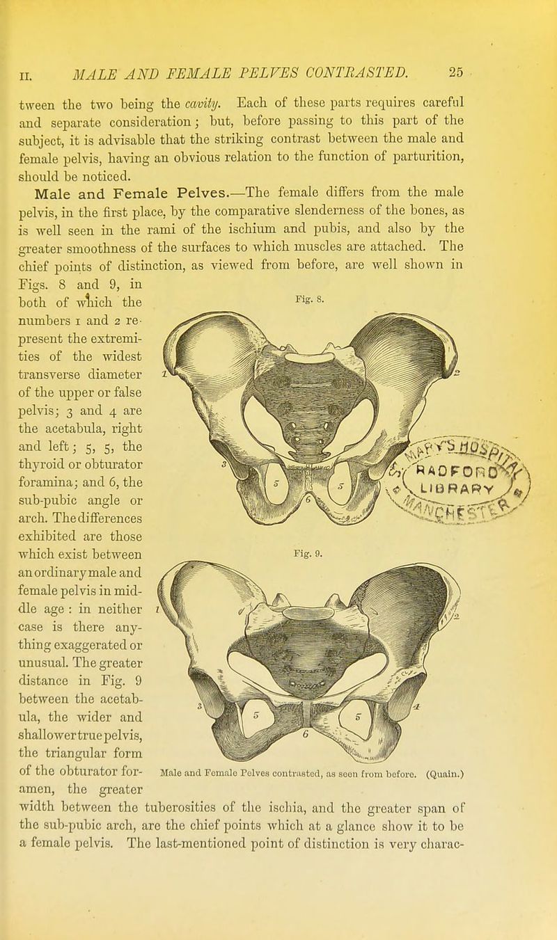both of which numbers i and Fig. 8. tween the two being the cavity. Each of these parts requires careful and separate consideration j but, before passing to this part of the subject, it is advisable that the striking contrast between the male and female pelvis, having an obvious relation to the function of parturition, should be noticed. Male and Female Pelves.—The female differs from the male pelvis, in the first place, by the comparative slenderness of the bones, as is well seen in the rami of the ischium and pubis, and also by the greater smoothness of the surfaces to which muscles are attached. The chief points of distinction, as viewed from before, are well shown in Figs. 8 and 9, in the 2 re- present the extremi- ties of the widest transverse diameter of the upper or false pelvis; 3 and 4 are the acetabula, right and left; 5, 5, the thyroid or obturator foramina; and 6, the sub-pubic angle or arch. The differences exhibited are those which exist between an ordinary male and female pelvis in mid- dle age : in neither case is there any- thing exaggerated or unusual. The greater distance in Fig. 9 between the acetab- ula, the wider and shallower true pelvis, the triangular form of the obturator for- amen, the greater width between the tuberosities of the ischia, and the greater span of the sub-pubic arch, are the chief points which at a glance show it to be a female pelvis. The last-mentioned point of distinction is very charac- 7*\ Male and Fcmalo Pelves contrasted, as seen from before. (Quain.)