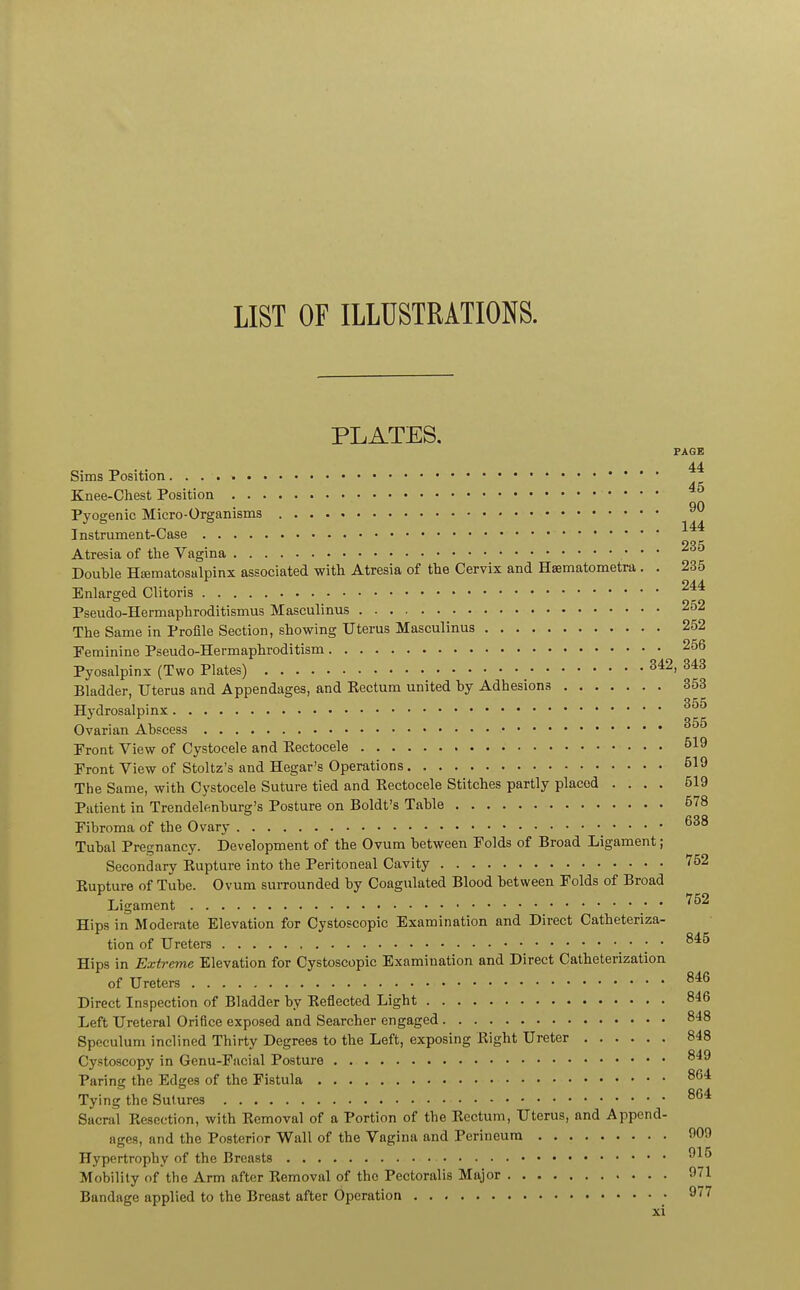 LIST OF ILLUSTRATIONS. PLATES. PAGE 44 Sims Position Knee-Chest Position on Pyogenic Micro-Organisms Instrument-Case 235 Atresia of the Vagina .• • ■ Douhle Hematosalpinx associated with Atresia of the Cervix and Hsematometra. . 235 Enlarged Clitoris 244 Pseudo-Hermaphroditismus Masculinus 252 The Same in Profile Section, showing Uterus Masculinus 252 Feminine Pseudo-Hermaphroditism 256 Pyosalpinx (Two Plates) _ 342,343 Bladder, Uterus and Appendages, and Rectum united by Adhesions 353 Hydrosalpinx 355 Ovarian Abscess 355 Front View of Cystocele and Eectocele 519 Front View of Stoltz's and Hegar's Operations 519 The Same, with Cystocele Suture tied and Eectocele Stitches partly placed .... 519 Patient in Trendelenburg's Posture on Boldt's Table 578 Fibroma of the Ovary • • • • 638 Tubal Pregnancy. Development of the Ovum between Folds of Broad Ligament; Secondary Eupture into the Peritoneal Cavity 752 Rupture of Tube. Ovum surrounded by Coagulated Blood between Folds of Broad Ligament • • ' Hips in Moderate Elevation for Cystoscopic Examination and Direct Catheteriza- tion of Ureters • • • 845 Hips in Extreme Elevation for Cystoscopic Examination and Direct Catheterization of Ureters 846 Direct Inspection of Bladder by Eeflected Light 846 Left Ureteral Orifice exposed and Searcher engaged 848 Speculum inclined Thirty Degrees to the Left, exposing Eight Ureter 848 Cystoscopy in Genu-Facial Posture 849 Paring the Edges of the Fistula 864 Tying the Sutures 864 Sacral Resection, with Removal of a Portion of the Rectum, Uterus, and Append- ages, and the Posterior Wall of the Vagina and Perineum 909 Hypertrophy of the Breasts • 9^ Mobility of the Arm after Removal of the Pectoralis Major 971 Bandage applied to the Breast after Operation 97