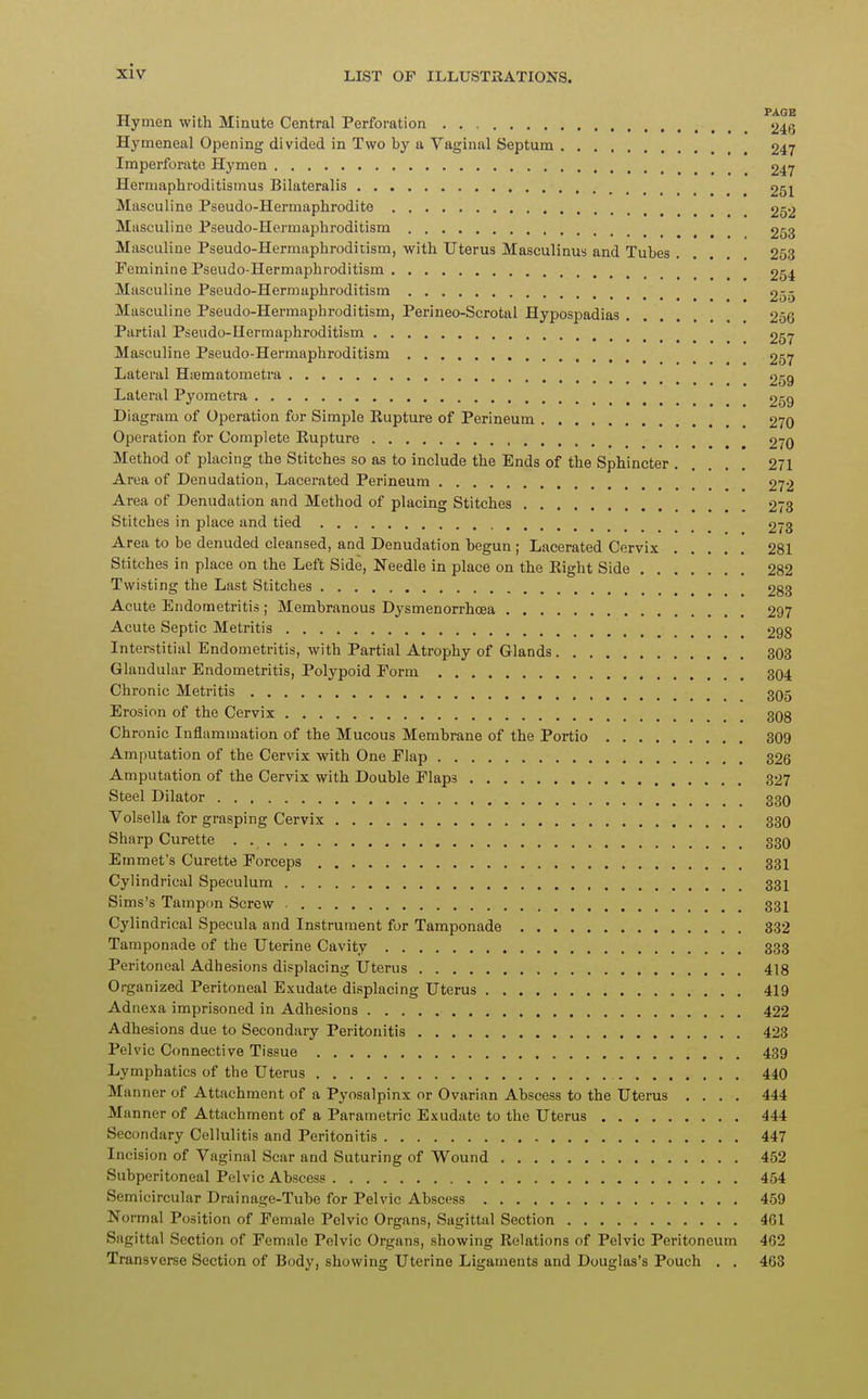 Hymen with Minute Central Perforation 246 Hymeneal Opening divided in Two by a Vaginal Septum 247 Imperforate Hymen 247 Hermaphroditismus Bilateralis 251 Masculine Pseudo-Hermaphrodite 252 Masculine Pseudo-Hermaphroditism 253 Masculine Pseudo-Hermaphroditism, with Uterus Masculinus and Tubes . . 253 Feminine Pseudo-Hermaphroditism 254 Masculine Pseudo-Hermaphroditism 255 Masculine Pseudo-Hermaphroditism, Perineo-Scrotal Hypospadias .... 256 Partial Pseudo-IIermaphroditism 257 Masculine Pseudo-Hermaphroditism 257 Lateral Haamatometra 259 Lateral Pyometra 259 Diagram of Operation for Simple Kupture of Perineum 270 Operation for Complete Rupture 270 Method of placing the Stitches so as to include the Ends of the Sphincter 271 Area of Denudation, Lacerated Perineum 272 Area of Denudation and Method of placing Stitches 273 Stitches in place and tied 273 Area to be denuded cleansed, and Denudation begun ; Lacerated Cervix 281 Stitches in place on the Left Side, Needle in place on the Right Side 282 Twisting the Last Stitches 283 Acute Endometritis ; Membranous Dysmenorrhcea 297 Acute Septic Metritis 298 Interstitial Endometritis, with Partial Atrophy of Glands 303 Glandular Endometritis, Polypoid Form 304 Chronic Metritis 305 Erosion of the Cervix 308 Chronic Inflammation of the Mucous Membrane of the Portio 309 Amputation of the Cervix with One Flap 326 Amputation of the Cervix with Double Flap3 327 Steel Dilator 330 Volsella for grasping Cervix 330 Sharp Curette . 330 Emmet's Curette Forceps 331 Cylindrical Speculum 331 Sims's Tampon Screw 331 Cylindrical Specula and Instrument for Tamponade 332 Tamponade of the Uterine Cavity 333 Peritoneal Adhesions displacing Uterus 418 Organized Peritoneal Exudate displacing Uterus 419 Adnexa imprisoned in Adhesions 422 Adhesions due to Secondary Peritonitis 423 Pelvic Connective Tissue 439 Lymphatics of the Uterus 440 Manner of Attachment of a Pyosalpinx or Ovarian Abscess to the Uterus .... 444 Manner of Attachment of a Parametric Exudate to the Uterus 444 Secondary Cellulitis and Peritonitis 447 Incision of Vaginal Scar and Suturing of Wound 452 Subperitoneal Pelvic Abscess 454 Semicircular Drainage-Tube for Pelvic Abscess 459 Normal Position of Female Pelvic Organs, Sagittal Section 461 Sagittal Section of Female Pelvic Organs, showing Relations of Pelvic Peritoneum 462 Transverse Section of Body, showing Uterine Ligaments and Douglas's Pouch . . 463