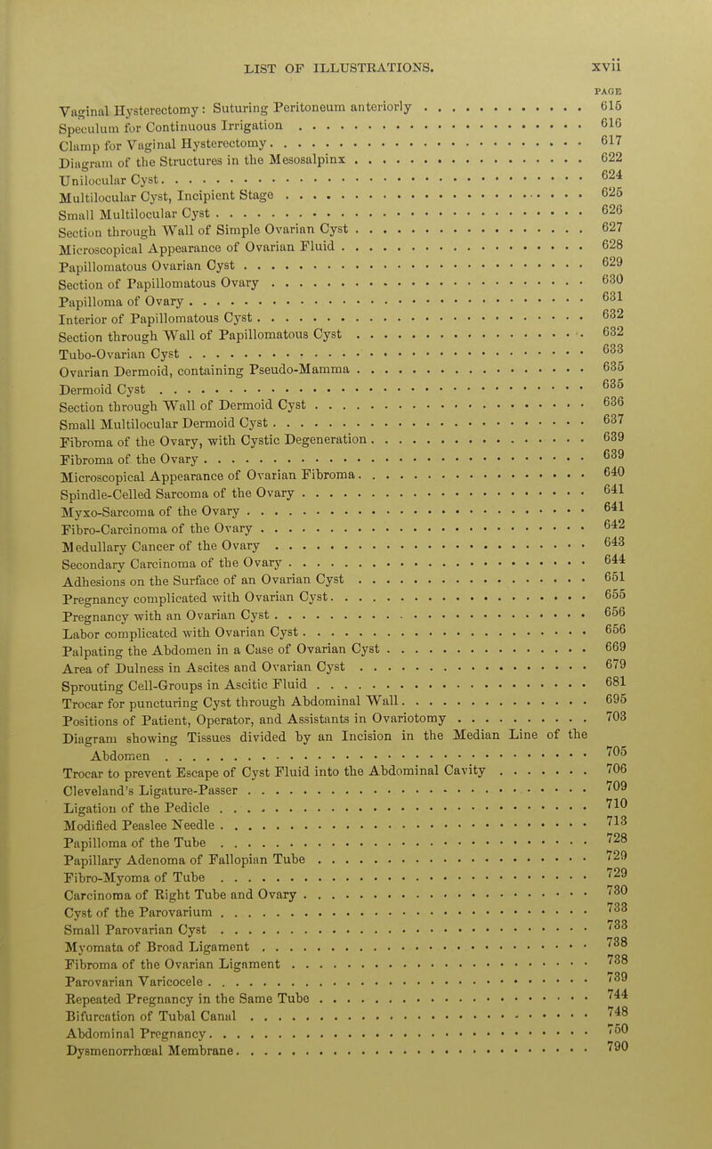 PAGE Vaginal Hysterectomy: Suturing Peritoneum anteriorly 615 Speculum for Continuous Irrigation 61G Clamp for Vaginal Hysterectomy 617 Diagram of the Structures in the Mesosalpinx 622 Unilocular Cyst 624 Multilocular Cyst, Incipient Stage 625 Small Multilocular Cyst 626 Section through Wall of Simple Ovarian Cyst 627 Microscopical Appearance of Ovarian Fluid 628 Papillomatous Ovarian Cyst 629 Section of Papillomatous Ovary 630 Papilloma of Ovary 631 Interior of Papillomatous Cyst 632 Section through Wall of Papillomatous Cyst 632 Tubo-Ovarian Cyst 633 Ovarian Dermoid, containing Pseudo-Mamma 635 Dermoid Cyst 635 Section through Wall of Dermoid Cyst 636 Small Multilocular Dermoid Cyst 637 Fibroma of the Ovary, with Cystic Degeneration 639 Fibroma of the Ovary 639 Microscopical Appearance of Ovarian Fibroma 640 Spindle-Celled Sarcoma of the Ovary 641 Myxo-Sarcoma of the Ovary 641 Fibro-Carcinoma of the Ovary 642 Medullary Cancer of the Ovary 643 Secondary Carcinoma of the Ovary 644 Adhesions on the Surface of an Ovarian Cyst 651 Pregnancy complicated with Ovarian Cyst 655 Pregnancy with an Ovarian Cyst 656 Labor complicated with Ovarian Cyst 656 Palpating the Abdomen in a Case of Ovarian Cyst 669 Area of Dulness in Ascites and Ovarian Cyst 679 Sprouting Cell-Groups in Ascitic Fluid 681 Trocar for puncturing Cyst through Abdominal Wall 695 Positions of Patient, Operator, and Assistants in Ovariotomy 703 Diagram showing Tissues divided by an Incision in the Median Line of the Abdomen 705 Trocar to prevent Escape of Cyst Fluid into the Abdominal Cavity 706 Cleveland's Ligature-Passer 7^9 Ligation of the Pedicle 710 Modified Peaslee Needle 713 Papilloma of the Tube 728 Papillary Adenoma of Fallopian Tube 729 Fibro-Myoma of Tube 729 Carcinoma of Eight Tube and Ovary 730 Cyst of the Parovarium i0° Small Parovarian Cyst 733 Myomata of Broad Ligament 738 Fibroma of the Ovarian Ligament 738 Parovarian Varicocele I0y Kepeated Pregnancy in the Same Tube 744 Bifurcation of Tubal Canal J48 Abdominal Pregnancy ' ^ Dysmenorrhceal Membrane 79^