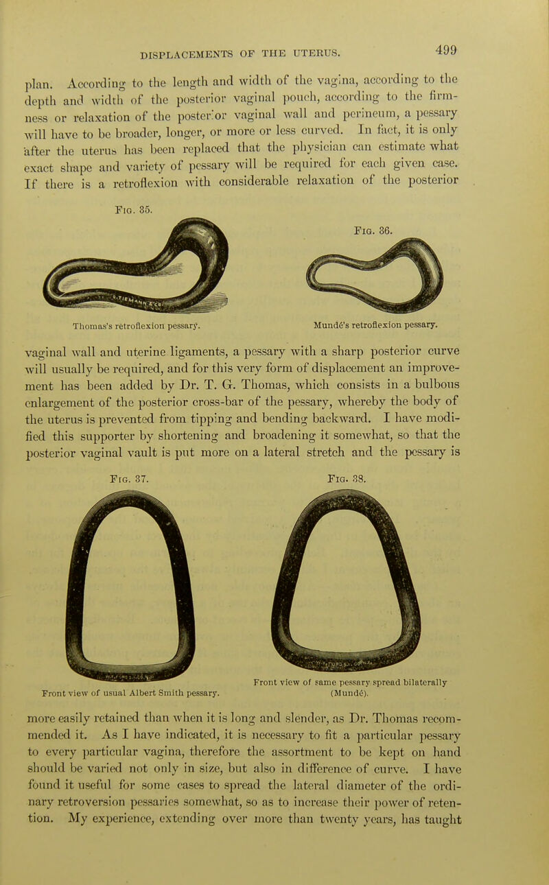 plan. According to the length and width of the vagina, according to the depth and width of the posterior vaginal pouch, according to the firm- ness or relaxation of the posterior vaginal wall and perineum, a pessary will have to be broader, longer, or more or less curved. In fact, it is only after the uterus has been replaced that the physician can estimate what exact shape and variety of pessary will be required for each given case. If there is a retroflexion with considerable relaxation of the posterior Fig. 35. Fig. 36. Thomas's retroflexion pessary. Munde's retroflexion pessary. vaginal wall and uterine ligaments, a pessary with a sharp posterior curve will usually be required, and for this very form of displacement an improve- ment has been added by Dr. T. G. Thomas, which consists in a bulbous enlargement of the posterior cross-bar of the pessary, whereby the body of the uterus is prevented from tipping and bending backward. I have modi- fied this supporter by shortening and broadening it somewhat, so that the posterior vaginal vault is put more on a lateral stretch and the pessary is Fig. 37. Fig. 38. Front view of usual Albert Smith pessary. (Mundti), more easily retained than when it is long and slender, as Dr. Thomas recom- mended it. As I have indicated, it is necessary to fit a particular pessary to every particular vagina, therefore the assortment to be kept on hand should be varied not only in size, but also in difference of curve. I have found it useful for some cases to spread the lateral diameter of the ordi- nary retroversion pessaries somewhat, so as to increase their power of reten- tion. My experience, extending over more than twenty years, has taught