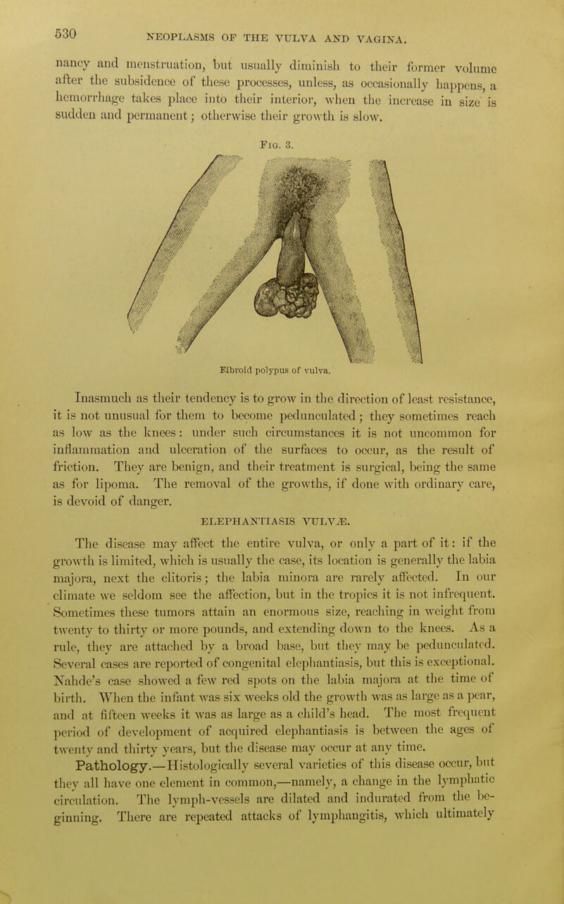 nancy and menstruation, but usually diminish to their former volume after the subsidence of these processes, unless, as occasionally happens, a hemorrhage takes place into their interior, when the increase in size is sudden and permanent; otherwise their growth is slow. Fig. 3. Fibroid polypus of vulva. Inasmuch as their tendency is to grow in the direction of least resistance, it is not unusual for them to become pedunculated; they sometimes reach as low as the knees: under such circumstances it is not uncommon for inflammation and ulceration of the surfaces to occur, as the result of friction. They are benign, and their treatment is surgical, being the same as for lipoma. The removal of the growths, if done with ordinary care, is devoid of danger. ELEPHANTIASIS VULVAE. The disease may affect the entire vulva, or only a part of it: if the growth is limited, which is usually the case, its location is generally the labia majora, next the clitoris; the labia minora are rarely affected. In our climate we seldom see the affection, but in the tropics it is not infrequent. Sometimes these tumors attain an enormous size, reaching in weight from twenty to thirty or more pounds, and extending down to the knees. As a rule, they are attached by a broad base, but they may be pedunculated. Several cases are reported of congenital elephantiasis, but this is exceptional. Nahde's case showed a few red spots on the labia majora at the time of birth. When the infant was six weeks old the growth was as large as a pear, and at fifteen weeks it was as large as a child's head. The most frequent period of development of acquired elephantiasis is between the ages of twenty and thirty years, but the disease may occur at any time. Pathology.—Histologically several varieties of this disease occur, but they all have one element in common,—namely, a change in the lymphatic circulation. The lymph-vessels are dilated and indurated from the be- ginning. There are repeated attacks of lymphangitis, which ultimately