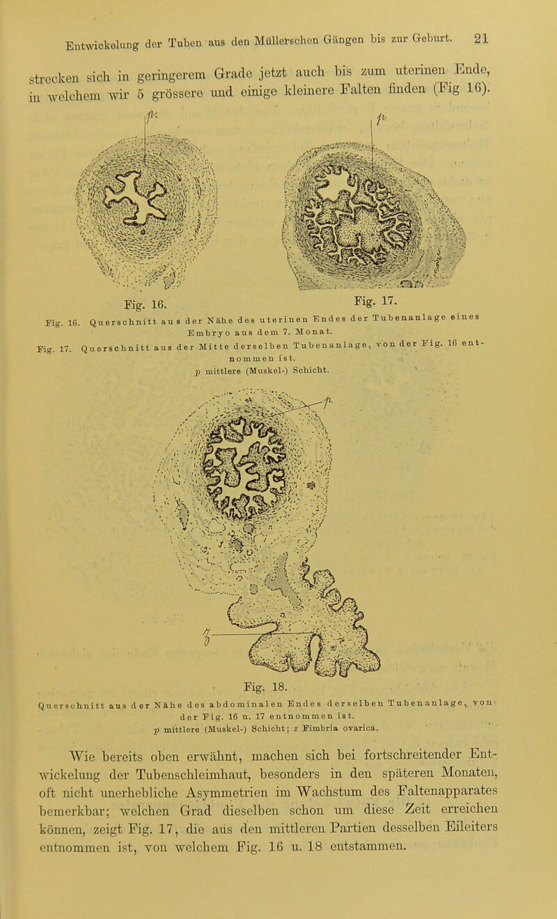 strecken sich in geringerem Grade jetzt auch bis zum uterinen Ende, in solchem wir 5 grössere und einige kleinere Falten finden (Fig 16). .-r'.K Fig. 16. V:- ^~K^V^i55>'-'' t Fig. 17. Fig. 16. Querschnitt aus der Nähe des uterinen Endes der Tubenanlage eines Embryo aus dem 7. Monat. Fig. 17. Querschnitt aus der Mitte derselben Tubenanlage, von der Fig. 16 ent- nommen ist. p mittlere (Muskel-) Schicht. Fig. 18. Querschnitt aus der Nähe des abdominalen Endes derselben Tubenanlage., von der Fig. 16 u. 17 entnommen ist. p mittlere (Muskel-) Schicht; z Fimbria ovarica. Wie bereits oben erwähnt, machen sich bei fortschreitender Ent- wickelung der Tubenschleimhaut, besonders in den späteren Monaten, oft nicht unerhebliche Asymmetrien im Wachstum des Faltenapparates bemerkbar; welchen Grad dieselben schon um diese Zeit erreichen können, zeigt Fig. 17, die aus den mittleren Partien desselben Eileiters entnommen ist, von welchem Fig. 16 u. 18 entstammen.