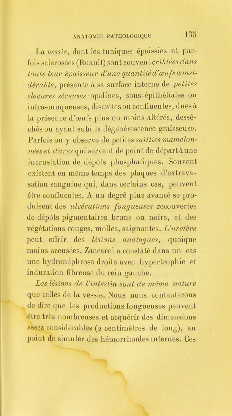La vessie, dont les tuniques epaissies et par- Ibis sclerosees (Ruaull) sont souvent criblees dans toute leur epaisseur d'une quantiled'aeufs consi- derable, presente a sa surface interne de petiles elevures sereuses opalines, sous-epitheliales ou intra-muqueuses, discretes ouconfluentes, dues a la presence d'ceufs plus ou moins alteres, desse- cbesou ayant subi la degenerescence graisseuse. Parfois on y observe de petites saillies mamelon- neeset dares qui servent de point de depart aune incrustation de depots phosphaliques. Souvent existent en meme temps des plaques d'extrava- sation sanguine qui, dans certains cas, peuvent etre confluentes. A un degre plus avance se pro- duisent des ulcerations fongueuses recouverles de dep6ts pigmentaires bruns ou noirs, et des vegetations rouges, molles, saignantes. L'urelere peut offrir des lesions analogues, quoique moins accusees. Zancarol a constate dans un cas une bydronephrose droite avec hypertropbie et induration fibreuse du rein gaucbe. Les lesions de I'intestin sont de meme nature que celles de la vessie. Nous nous contenterons de dire que les productions fongueuses peuvent etre tres nombreuses et acquerir des dimensions assez considerables (2 centimetres de long), au point de simuler des hemorrhoi'des internes. Ccs