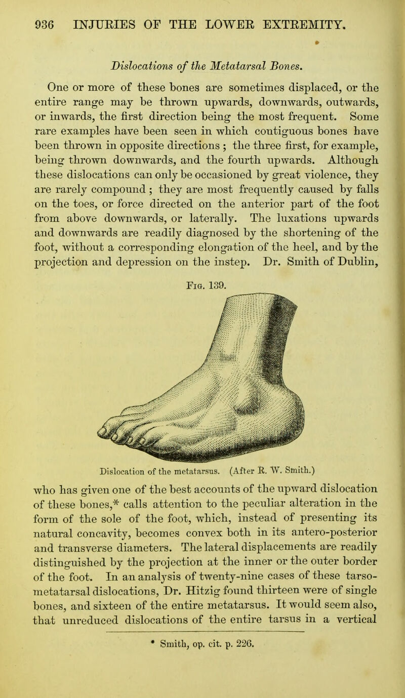 Dislocations of the Metatarsal Bones. One or more of these bones are sometimes displaced, or tlie entire range maj be throvm upwards, downwards, outwards, or inwards, the first direction being the most frequent. Some rare examples have been seen in which contiguous bones have been thrown in opposite directions ; the three first, for example, being thrown downwards, and the fourth upwards. Although these dislocations can only be occasioned by great violence, they are rarely compound ; they are most frequently caused by falls on the toes, or force directed on the anterior part of the foot from above downwards, or laterally. The luxations upwards and downwards are readily diagnosed by the shortening of the foot, without a corresponding elonga tion of the heel, and by the projection and depression on the instep. Dr. Smith of Dublin, Fio. 139. Dislocation of the metcatarsus. (After E. W. Smith.) who has given one of the best accounts of the upward dislocation of these bones,* calls attention to the peculiar alteration in the form of the sole of the foot, which, instead of presenting its natural concavity, becomes convex both in its antero-posterior and transverse diameters. The lateral displacements are readily distinguished by the projection at the inner or the outer border of the foot. In an analysis of twenty-nine cases of these tarso- metatarsal dislocations, Dr. Hitzig found thirteen were of single bones, and sixteen of the entire metatarsus. It would seem also, that unreduced dislocations of the entire tarsus in a vertical * Smith, op. cit. p. 226.