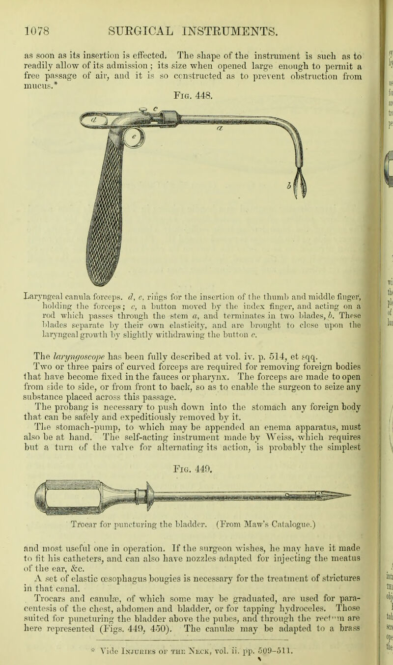 as soon as its insertion is eflected. The shape of the instrument is such as to readily allow of its admission ; its size when opened large enough to permit a free passage of air, aud it is so ccn-;tructed as to prevent obstruction from mucus.* Fig. 448. Larvngoal caniila forceps, d, c. rings for the insertion of the thumb and middle finger, liolding tlio forceps; c, a button moved by the index finger, and acting on a rod which passes through the stem a, and terminates in two blades, h. These blades separate by their own elasticity, and are brought to close upon the laryngeal growth by slightly withdrawing the button c. The laryni/oscope has been fully described at vol. iv. p. 514, et sqq. Two or three pairs of curved forceps are required for removing foreign bodies that have become fixed in the fauces or pharynx. The forceps are made to open from side to side, or from front to back, so as to enable the surgeon to seize any substance placed across this passage. The probang is necessary to push down into the stomach any foreign body that can be safely and expeditiously removed by it. The stomach-pump, to which may be appended an enema apparatus, must also be at hand. The self-acting instrument made by Weiss, which requires but .1 turn of the valve for alternating its action, is probably the simplest Fig. 440. Trocar for puncturing the bladder, (b'rom Maw's Catalogne.) and most useful one in operation. If the surgeon wishes, he may have it made to fit his catheters, and can also have nozzles adapted for injecting the meatus of the ear, &c. A set of elastic oesophagus bougies is necessary for the treatment of .strictures in that canal. Trocars and canuhr, of which some may be graduated, are used for para- centesis of the chest, abdomen and bladder, or for tapping hydroceles. Those suited for puncturing the bladder above the pubes, and through the rec1m are here represented (Figs. 449, 4o0). The canulse may be adapted to a brass A'ide Injuries of the Neck, vol. ii. pp. COO-oll.