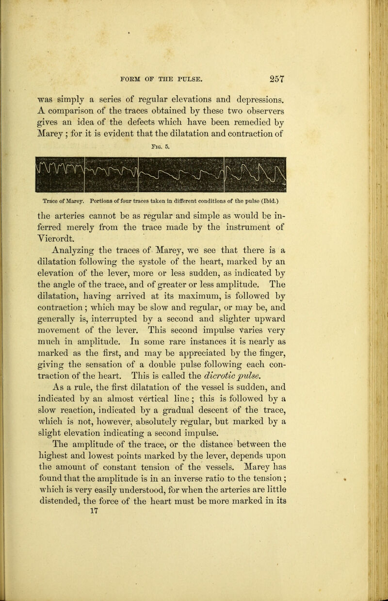 was simply a series of regular elevations and depressions. A comparison of the traces obtained by these two observers gives an idea of the defects which have been remedied by Marey; for it is evident that the dilatation and contraction of Pig. 5. Trace of Marey. Portions of four traces taken in different conditions of the pulse (Ibid.) the arteries cannot be as regular and simple as would be in- ferred merely from the trace made by the instrument of Yierordt. Analyzing the traces of Marey, we see that there is a dilatation following the systole of the heart, marked by an elevation of the lever, more or less sudden, as indicated by the angle of the trace, and of greater or less amplitude. The dilatation, having arrived at its maximum, is followed by contraction; which may be slow and regular, or may be, and generally is, interrupted by a second and slighter upward movement of the lever. This second impulse varies very much in amplitude. In some rare instances it is nearly as marked as the first, and may be appreciated by the finger, giving the sensation of a double pulse following each con- traction of the heart. This is called the dicrotic pulse. As a rule, the first dilatation of the vessel is sudden, and indicated by an almost vertical line; this is followed by a slow reaction, indicated by a gradual descent of the trace, which is not, however, absolutely regular, but marked by a slight elevation indicating a second impulse. The amplitude of the trace, or the distance between the highest and lowest points marked by the lever, depends upon the amount of constant tension of the vessels. Marey has found that the amplitude is in an inverse ratio to the tension; which is very easily understood, for when the arteries are little distended, the force of the heart must be more marked in its 17