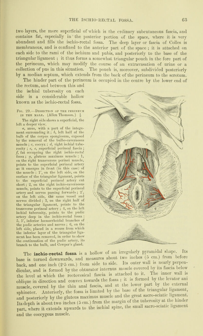 Fig. 29.—Dissection of the perineum in the male. (Allen Thomson.) \ The right side shows a superficial, the left a deeper view. a, anus, with a part of the integu¬ ment surrounding it; b, left half of the bulb of the corpus spongiosum, exposed by the removal of the bulbo-cavernosus muscle ; c, coccyx ; d, right ischial tube¬ rosity ; e, e, superficial perineal fascia ; /, fat occupying the right ischio-rectal fossa; g, gluteus maximus muscle ; 1, on the right transversus perinei muscle, points to the superficial perineal artery as it emerges in front (in this case) of the muscle ; 1', on the left side, on the surface of the triangular ligament, points to the superficial perineal artery cut short; 2, on the right ischio-cavernosus muscle, points to the superficial perineal artery and nerves passing forwards ; 2', on the left side, the same vessel and nerves divided ; 3, on the right half of the triangular ligament, points to the transverse perineal artery ; 4, on the left ischial tuberosity, points to the pudic artery deep in the ischio-rectal fossa ; 5. 5', inferior hsemorrhoidal branches of the pudic arteries and nerves ; 6, on the left side, placed in a recess from which the inferior layer of the triangular liga¬ ment has been removed, in order to show the continuation of the pudic artery, its branch to the bulb, and Cowper’s gland. two layers, the more superficial of which is the ordinary subcutaneous fascia, and contains fat, especially in the posterior portion of the space, where it is very abundant and fills the ischio-rectal fossa. The deep layer or fascia of Colies is membranous, and is confined to the anterior part of the space ; it is attached on each side to the rami of the ischium and pubis, and posteriorly to the base of the triangular ligament ; it thus forms a somewhat triangular pouch in the fore part of the perineum, which may modify the course of an extravasation of urine or a collection of pus in this situation. The pouch is, moreover, subdivided posteriorly by a median septum, which extends from the back of the perineum to the scrotum. The hinder part of the perineum is occupied in the centre by the lower end of the rectum, and between this and the ischial tuberosity on each side is a considerable hollow known as the ischio-rectal fossa. The ischio-rectal fossa is a hollow of an irregularly pyramidal shape Its base is turned downwards, and measures about two inches (5 cm.) from before back, and one inch (2-5 cm.) from side to side. Its outer wall is nearly perpen¬ dicular, and is formed by the obturator internus muscle covered by its fascia below the level at which the rectovesical fascia is attached to it. The inner wall is oblique in direction and convex towards the fossa ; it is formed by the levatoi am muscle, covered by the thin anal fascia, and at the lower part by the external sphincter. Anteriorly, the fossa is limited by the base of the triangular hgamen , and posteriorly by the gluteus maximus muscle and the great sacro-sciatic ligament. Its depth is about two inches (5 cm.) from the margin of the tuberosity at the hinder part, where it extends upwards to the ischial spine, the small sacro-sciatic ligament and the coccygeus muscle.