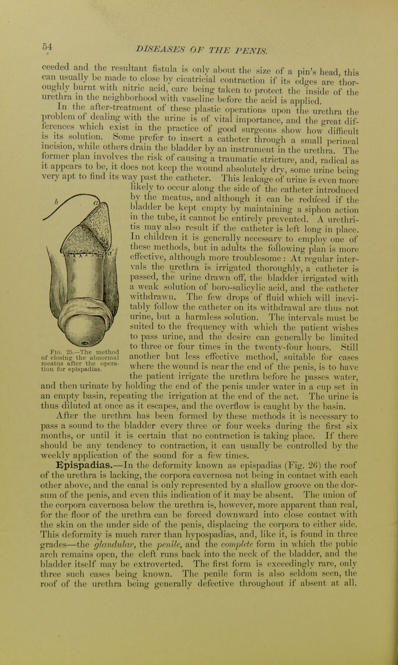 ceedcd and the resultant fistula is only aboul the size of a pin's head this can usually be made to close by cicatricial contraction if its edges arc thor- oughly burnt with nitnc acid, oare being taken to protect the inside of the urethra m the neighborhood with vaseline before the acid is applied In the after-treatment of these plastic operations upon the urethra the problem of dealing with the urine is of vital importance, and the great dif- ferences which exist in the practice of good surgeons show how difficult is its solution. Some prefer to insert a catheter through a small perineal incision, while others drain the bladder by an instrument in the urethra The former plan involves the risk of causing a traumatic stricture, and, radical as it appears to be, it does not keep the wound absolutely dry, some urine being very apt to find its M ay past the catheter. This leakage of urine is even more likely to occur along the side of the catheter introduced by the meatus, and although it can be reduced if the bladder be kept empty by maintaining a siphon action in the tube, it cannot be entirely prevented. A urethri- tis may also result if the catheter is left long in place. In children it is generally necessary to employ one of these methods, but in adults the following plan is more effective, although more troublesome : At regular inter- vals the urethra is irrigated thoroughly, a catheter is passed, the urine drawn off, the bladder irrigated with a weak solution of boro-salicylic acid, and the catheter withdrawn. The few drops of fluid which will inevi- tably follow the catheter on its withdrawal are thus not urine, but a harmless solution. The intervals must be suited to the frequency with which the patient wishes to pass urine, and the desire can generally be limited to three or four times in the twenty-four hours. Still another but less effective method, suitable for cases where the wound is near the end of the penis, is to have the patient irrigate the urethra before he passes water, and then urinate by holding the end of the penis under M ater in a cup set in an empty basin, repeating the irrigation at the end of the act. The urine is thus diluted at once as it escapes, and the overflow is caught by the basin. After the urethra has been formed by these methods it is necessary to pass a sound to the bladder every three or four weeks during the first six months, or until it is certain that no contraction is taking place. If there should be any tendency to contraction, it can usually be controlled by the weekly application of the sound for a few times. Epispadias.—In the deformity known as epispadias (Fig. 26) the roof of the urethra is lacking, the corpora cavernosa not being in contact w ith each other above, and the canal is only represented by a shallow groove on the dor- sum of the penis, and even this indication of it may be absent. The union of the corpora cavernosa below the urethra is, however, more apparent than real, (in- the floor of the urethra can be forced downward into close contact with the skin on the under side of the penis, displacing the corpora to either side. This deformity is much rarer than hypospadias, and, like it, is found in three grades—the (/landular, the 'penile, and the complete form in which the pubic arch remains open, the cleft runs back into the neck of the bladder, and the bladder itself may be extroverted. The firsl form is exceedingly rare, only three such cases being known. The penile form is also seldom seen, the roof of the urethra being generally defective throughout if absent at all. Fig. 25.—The method of closing the abnormal meatus after the opera- tion for epispadias.