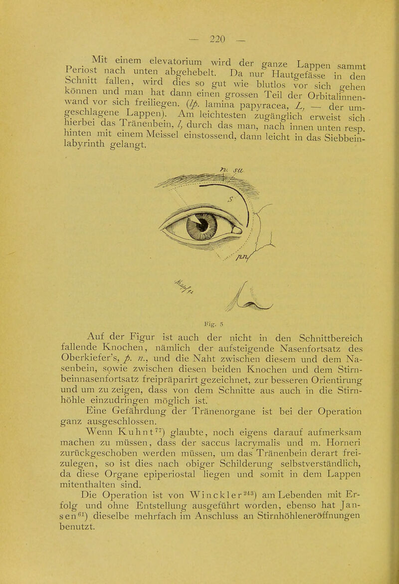 _ Mit einem elevatonum wird der ganze Lappen sammt Penos nach unten abgehebelt. Da nur Hautgefässe in Tn Schnitt fallen, wird dies so gut wie blutlos ^or sich gehen können und man hat dann einen grossen Teil der Orbitalinnen- wand vor sicli freihegen. {Ip. lamina papyracea, L, ~ der um- geschlagene Lappen). Am leichtesten zugänglich erweist sich hierbei das Tränenbein, /, durch das man, nach innen unten resp unten mit einem Meissel einstossend, dann leicht in das Siebbein- labyrmth gelangt. Fig. 5 Auf der Figur ist auch der nicht in den Schnittbereich fallende Knochen, nämlich der aufsteigende Nasenfortsatz des Oberkiefer's,und die Naht zwischen diesem und dem Na- senbein, sowie zwischen diesen beiden Knochen und dem Stirn- beinnasenfortsatz freipräparirt gezeichnet, zur besseren Orientirung und um zu zeigen, dass von dem Schnitte aus auch in die Stirn- höhle einzudringen möglich ist. Eine Gefährdung der Tränenorgane ist bei der Operation ganz ausgeschlossen. Wenn Kuhnt) glaubte, noch eigens darauf aufmerksam machen zu müssen, dass der saccus lacrymalis und m. Horneri zuriickgeschoben werden müssen, um das Tränenbein derart frei- zulegen, so ist dies nach obiger Schilderung selbstverständlich, da diese Organe epiperiostal liegen und somit in dem Lappen mitenthalten sind. Die Operation ist von Winckle r ^**') am Lebenden mit Er- folg und ohne Entstellung ausgeführt worden, ebenso hat Jan- sen''^) dieselbe mehrfach im Anschluss an Stirnhöhleneröffnungen benutzt.