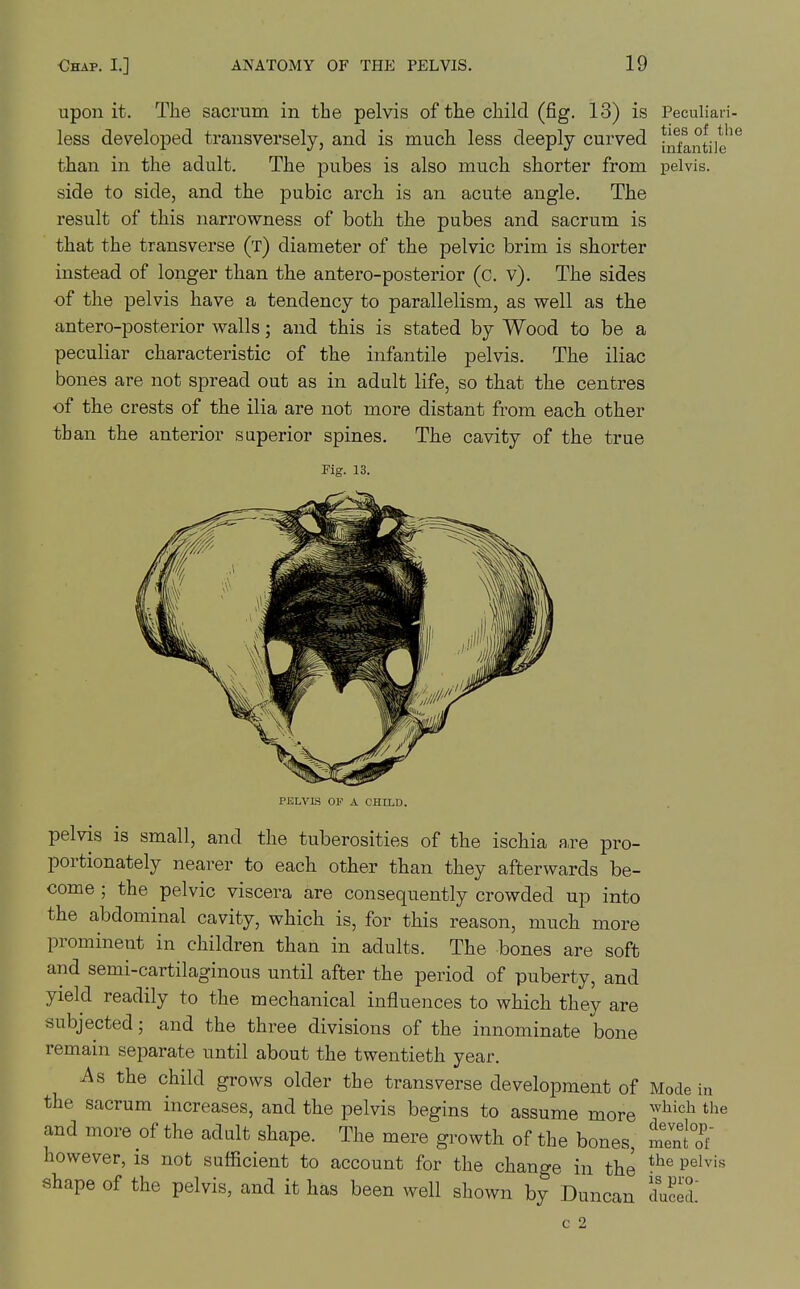 upon it. The sacrum in the pelvis of the child (fig. 13) is Peculiari- less developed transversely, and is much less deeply curved jn^fantile^^ than in the adult. The pubes is also much shorter from pelvis, side to side, and the pubic arch is an acute angle. The result of this narrowness of both the pubes and sacrum is that the transverse (t) diameter of the pelvic brim is shorter instead of longer than the antero-posterior (c. v). The sides of the pelvis have a tendency to parallelism, as well as the antero-posterior walls; and this is stated by Wood to be a peculiar characteristic of the infantile pelvis. The iliac bones are not spread out as in adult life, so that the centres of the crests of the ilia are not more distant from each other than the anterior superior spines. The cavity of the true Fig. 13. PELVLS OP A CHILD. pelvis is small, and the tuberosities of the ischia are pro- portionately nearer to each other than they afterwards be- come ; the pelvic viscera are consequently crowded up into the abdominal cavity, which is, for this reason, much more prominent in children than in adults. The bones are soft and semi-cartilaginous until after the period of puberty, and yield readily to the mechanical influences to which they are subjected; and the three divisions of the innominate bone remain separate until about the twentieth year. As the child grows older the transverse development of Mode in the sacrum increases, and the pelvis begins to assume more and more of the adult shape. The mere growth of the bones, ment'Tf however, is not sufficient to account for the change in the ^^^'^ shape of the pelvis, and it has been well shown by Duncan Zfel