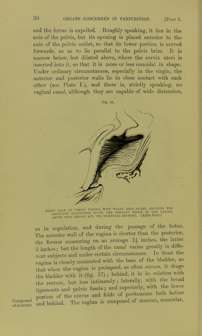 and tlie foetus is expelled. . Roughly speaking, it lies in the axis of the pelvis, but its opening is placed anterior to the axis of the pelvic outlet, so that its lower portion is curved forwards, so as to lie parallel to the pelvic brim. It is narrow below, but dilated above, where the cervix uteri is inserted into it, so that it is more or less conoidal in shape. Under ordinary circumstances, especially in the virgin, the anterior and posterior walls lie in close contact with each other (see Plate I.), and there is, strictly speaking, no vaginal canal, although they are capable of wide distension, Fig. 16. HALF OP VIRGIV V.VOINA, WITU WALLS HELD APART, SHOWING THE JND^NT TRANSVEllSE RUG.E. THE GREATER DEPTH OF THE VAGINA ^vi.-'th»N- BKLOW. AND THE HYMENEAL 8EU.MENT. (After Hart.) KISHT ABUN ABOVE THAN BKLOW, AN as in copulation, and during the passage of the foetus. The anterior wall of the vagina is shorter than the posterior, the former measuring on an average 2^ inches, the latter 3 inches ; but the length of the canal varies greatly in diffe- rent subjects and under certain circumstances. In front the vagina is closely connected with the base of the bladder, so that when the vagina is prolapsed, as often occurs, it drags the bladder with it (fig. 17) ; behind, it is in relation with the rectum, but less intimately ; laterally, with the broad licaments and pelvic fascia; and superiorly, with the lower portion of the uterus and folds of peritoneum both before Composed ^ rpj^^ -^^ is composed of mucous, muscular, of mucous ciuu ucui-j-i^v^. a