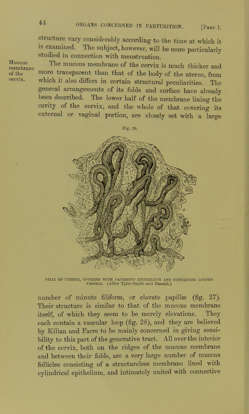 ORGANS CONCEKNED IN TARTURITION. [Paht I. Mucous membrane of the cervix. Structure vary considerably according to the time at whicli it IS examined. The subject, however, will be more particularly studied in connection with menstruation. The mucous membrane of the cei-vix is much thicker and more transparent than that of the body of the uterus, from which it also differs in certain structural peculiarities. The general arrangements of its folds and surface have already been described. The lower half of the membrane lining the cavity of the cervix, and the whole of that covering its external or vaginal portion, are closely set with a large Fig. 28. VILLI OF UTERUS, COVERED WITH PAVBMEKT EPITHEUU5I AND CONTAINING LOOPED VESSELS. (After Tyler Smith and Hassall.) number of minute filifoi*m, or clavate papillaa (fig. 27). Their structure is similar to that of the mucous membrane itself, of which they seem to be merely elevations. They each contain a vascular loop (fig. 28), and they are believed by Kilian and Farre to be mainly concerned in giving sensi- bility to this part of the generative tract. All over the interior of the cervix, both on the ridges of the mucous membrane and between their folds, are a very large number of mucous follicles consisting of a structureless membrane lined with cylindrical epithelium, and intimately united with connective