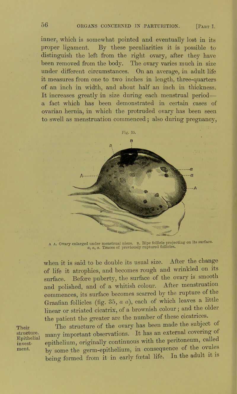 66 inner, which is somewhat pointed and eventually lost in its proper ligament. By these peculiarities it is possible to distinguish the left from the right ovary, after they have been removed from the body. The ovary varies much in size under diflfereiit circumstances. On an average, in adult life it measures from one to two inches in length, three-quarters of an inch in width, and about half an inch in thickness. It increases greatly in size during each menstrual period— a fact which has been demonstrated in certain cases of ovarian hernia, in which the protruded ovary has been seen to swell as menstruation commenced; also dui-iug pregnancy, Fig. 35. B A A. Ovary enlarged under menstrual iiisus. b. Ripe follicle projectiug on a, a, a. Traces of previously ruptured follicles. Their structure. Epithelial invest- ment. when it is said to be double its usual size. After the change of life it atrophies, and becomes rough and wrinkled on its surface. Before puberty, the surface of the ovary is smooth and polished, and of a whitish colour. After menstruation commences, its surface becomes scarred by the rupture of the Graafian follicles (fig. 35, a a), each of which leaves a little linear or striated cicatrix, of a brownish colour ; and the older the patient the greater are the number of these cicatrices. The structure of the ovary has been made the subject of many important observations. It has an external covering of epithelium, originally continuous with the peritoneum, called by some the germ-epithelium, in consequence of the ovules being formed from it in early foetal life. In the adult it is