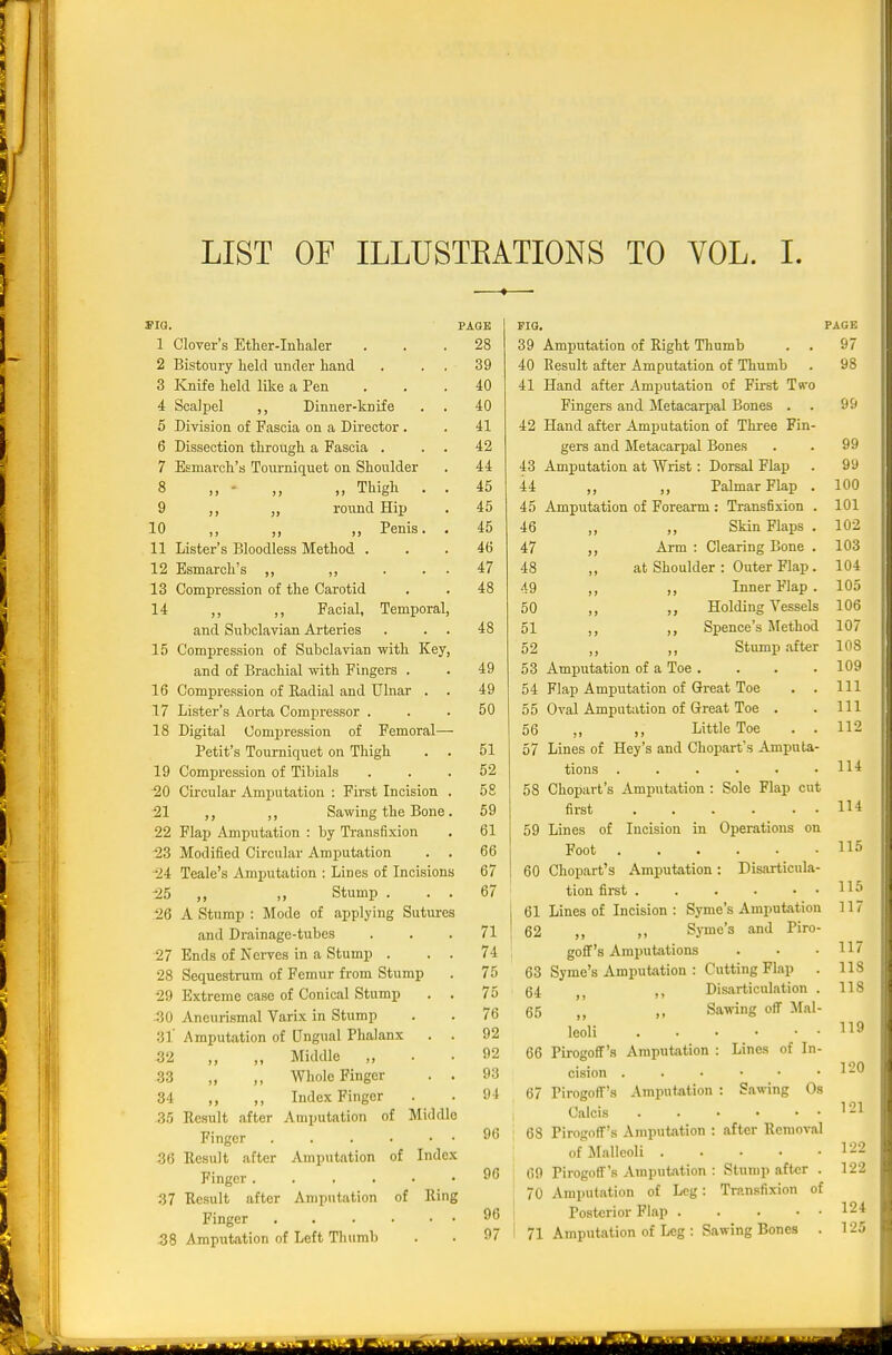 LIST OF ILLUSTEATIONS TO VOL. L pia, 1 2 3 4 5 Clover's Etlier-Inhaler Bistoury lield under liand ICnife held like a Pen Scalpel ,, Dinner-knife Division of Fascia on a Director . 6 Dissection througk a Fascia . 7 Esmarck's Toiu-niquet on Shoulder 8 „  „ „ Thigh . 9 ,, „ round Hij) 10 „ „ Penis. 11 Lister's Bloodless Method . 12 Esmarch's ,, ,, . . 13 Compression of the Carotid 14 ,, ,, Facial, Temporal and Subclavian Arteries 15 Compression of Subclavian with Key, and of Brachial with Fingers . 16 Comijression of Kadial and Ulnar . 17 Lister's Aorta Compressor . 18 Digital Compression of Femoral— Petit's Tourniquet on Thigh 19 Compression of Tibials 20 Circular Amputation : First Incision 21 ,, Sawing the Bone 22 Flap Amputation : by Transfixion •23 Modified Circular Amputation •24 Teale's Amputation ; Lines of Incisions •25 „ ,, Stump . 26 A Stump : Mode of applying Sutures and Drainage-tubes 27 Ends of Nei-ves in a Stump . 28 Sequestrum of Femur from Stump 29 Extreme case of Conical Stump 430 Aneurismal Varix in Stump 31' Amputation of Ungual Phalanx . 32 ,, ,, Middle „ 33 ,, ,, Whole Finger 34 ,, ,, Index Finger 35 Result after Amputation of Middl Finger . . . . • 36 Result after Amputation of Index Finger . . . . • 37 Result after Amputation of Ri Finger 58 Amputation of Left Thumb PAQK 28 39 40 40 41 42 44 45 45 45 46 47 48 48 49 49 50 51 52 58 59 61 66 67 67 71 74 75 75 76 92 92 93 94 96 96 96 97 via. 39 Amputation of Right Tliumb 40 Result after Amputation of Thumb 41 Hand after Amputation of First T«-o Fingers and Metacarjjal Bones , 42 Hand after Amputation of Three Fin- gers and Metacarpal Bones 43 Amputation at Wrist: Dorsal Flap 44 ,, Palmar Flap . 45 Amputation of Forearm: Transfixion . 46 ,, Skin Flaps . 47 ,, Arm : Clearing Bone . 48 ,, at Shoulder : Outer Flap. 49 ,, ,, Inner Flap . 50 ,, ,, Holding Vessels 51 ,, Spence's Method 52 ,, ,, Stump after 53 Amijutation of a Toe .... 54 Flap Amputation of Great Toe . . 55 Oval Amputation of Great Toe . 56 „ ,, Little Toe . . 57 Lines of Hey's and Chopart's Amputa- tions ...... 58 Chopart's Amputation : Sole Flap cut first 59 Lines of Incision in Operations on Foot 60 Chopart's Amputation: Disarticula- tion first . . . . • • 61 Lines of Incision : Syme's Amputation 62 ,, ,, Syme's and Piro- goff's Amputations 63 Syme's Amputation : Cutting Flap . 64 Disarticulation . 65 „ Sawing off Mal- leoli . • • • • • 66 Pirogoff's Amputation : Lines of In- cision 67 Pirogoff's Amputation : Sawing Os Calcis . . • • • • 68 Pirogoff's Amputation : after Removal of ^lallcoli . . . . • 69 Pirogoff's Amputation : Stump after . 70 Amputation of Leg: Transfixion of Posterior Flap 71 Amputation of Leg : Sawing Bones . PAGE 97 98 99 99 99 100 101 102 103 104 105 106 107 108 109 111 in 112 114 114 115 115 117 117 118 118 119 120 121 122 122 124 125