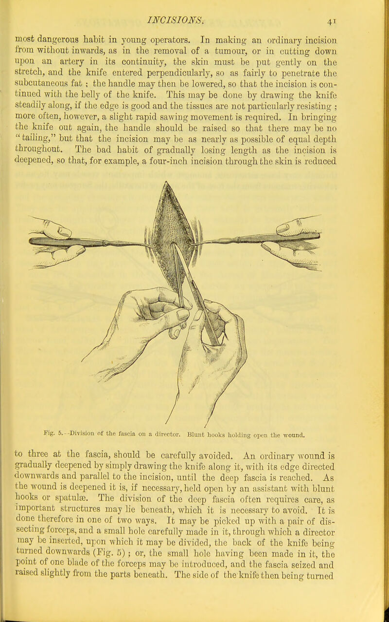 most dangerous habit in young operators. In making an ordinary incision from without inwards, as in the removal of a tumour, or in cutting down upon an artery in its continuity, the skin must be put gently on the stretch, and the knife entered perpendicularly, so as fairly to penetrate the subcutaneous fat ; the handle may then be lowered, so that the incision is con- tinued with the belly of the knife. This may be done by drawing the knife steadily along, if the edge is good and the tissues are not particularly resisting ; more often, however, a slight rapid sawing movement is required. In bringing the knife out again, the handle should be raised so that there may be no  taihng, but that the incision may be as nearly as possible of equal depth throughout. The bad habit of gradually losing length as the incision is deepened, so that, for example, a four-inch incision through the skin is reduced Fig. 6.--Division of tho fascia on a director. Blunt liool;s holding open the -(vouncl. to three at the fascia, should be carefully avoided. An ordinary wound is gradually deepened by simply drawing the knife along it, with its edge directed downwards and parallel to the incision, until the deep fascia is reached. As the wound is deepened it is, if necessary, held open by an assistant with blunt hooks or spatula. The division of the deep fascia often requires care, as important stractures may lie beneath, which it is necessary to avoid. It is done therefore in one of two ways. It may be picked up with a pair of dis- secting forceps, and a small hole carefully made in it, through which a director may be inserted, upon which it may be divided, the back of the knife being turned downwards (Fig. 5); or, the small hole having been made in it, the point of one blade of the forceps may be introduced, and the fascia seized and raised shghtly from the parts beneath. The side of the knife then being turned