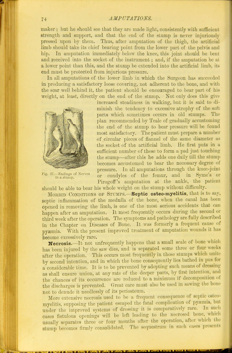 maker ; but he should see that they are made light, consistently with sufficient strength and support, and that the end of the stump is never injuriously pressed upon by them. Thus, after amputation of the thigh, tlie artificial limb should take its chief bearing point from the lower part of the pelvis and hip. In amputation immediately below the knee, this joint should be bent and received into the socket of the instrument; and, if the amputation be at a lower point than this, and the stump be extended into the artificial limb, its end must be protected from injurious pressure. In all amputations of the lower limb in which the Surgeon has succeeded in producing a satisfactory loose covering, not adherent to the bone, aud witli the scar w^ell behind it, the patient should be encouraged to Ijear part of his weight, at least, directly on the cud of the stump. Not only does this give increased steadiness in walking, but it is said to di- minish tlie tendency to excessive atrophy of the soft parts which sometimes occurs in old stumps. The plan recommended by Teale of gradually accustoming the end of the stump to bear pressm-e will be found most satisfactory. The patient must prepare a number of circular pieces of flaunel of the same diameter as the socket of the artificial limb. He first puts in a sufficient number of these to form a pad just touching the stump—after this he adds one daily till the stum]i becomes accustomed to bear the necessary degree of pressure. In all amputations through the knee-joint or condyles of the femur, and in Syme's or Pirogoff's amputation at the ankle, the patient should be able to bear his whole weight on the stump without difficulty. Morbid Conditions of Stumps.—Septic osteo-myelitis, that is to say, septic inflammation of the medulla of the bone, when the canal has been opened in removing the limb, is one of the most serious accidents that can happen after an amputation. It most frequently occurs during the second or third week after the operation. The symptoms and pathology are fully described in the Chapter on Diseases of Bone. It was formeriy a frequent cause of pyaemia. With the present improved treatment of amputation M'ounds it has become excessively rare. Necrosis.—It not unfrequently happens that a small scale of bone which has been injured by the saw dies, and is separated some three or foiir weeks after the operation. This occurs most frequently in those stumps which unite by second intention, and in which the bone consequently lies bathed in pus for a considerable time. It is to be prevented by adopting such means of dressing as shall ensure union, at any rate of the deeper parts, by first intention, and the chances of its occurrence arc reduced to a minimum if decomposition <il the discharges is prevented. Great care must also be used in sawing the bone not to denude it needlessly of its periosteum. More extensive necrosis used to be a fi-cquent consequence of scjitic osteo- myelitis, supposing the patient escaped the fatal complication of pyfcinia, but under the improved systems of dressing it is comparatively rare. In such cases fistulous openings will be left leading to the necrosed bone, which usually separates three or four months after the operation, after which the stump becomes firmlv consolidated. The seqtrestrum in such cases proscuts Fig. 27.—Endings of Nerves in a stump.