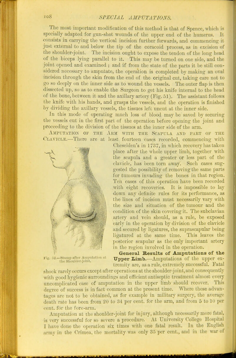 io8 The most imijortant Biodification of tliis method is that of Speuce, which is specially adapted for gun-sliot wounds of the upper end of the humerus. It <jonsists in carrying the vertical incision further forwards, and commencing it just external to and below the tip of the coracoid process, as in excision ol' the shoulder-joint. The incision ought to expose the tendon of the long head of the biceps lying parallel to it. This may be turned on one side, and the joint opened and examined ; and if fi'ora the state of the parts it be still con- sidered necessary to amputate, the operation is completed by making an oval incision through the skin from the end of the original cut, taking care not to go so deeply on the inner side as to wound the vessels. The outer flap is then •dissected up, so as to enable the Surgeon to get his knife internal to the head of the bone, between it and the axillary artery (Fig. 51). The assistant follows the knife with his hands, and grasps the vessels, and the oj^eration is finished by dividing the axillary vessels, the tissues left uncut at the inner side. In this mode of operating much loss of blood may be saved by securing the vessels cut in the first part of the operation before opening the joint and proceeding to the division of the tissues at the inner side of the arm. Amputatiox of the Arm with the Scapula axd part of the Clavicle.—There are at least fourteen cases recorded, commencing with Cheselden's in 1737, in which recovery has taken place after the Avhole upper limb, together with the scapula and a greater or less part of the clavicle, has been torn away. Such cases sug- gested the possibility of removing the same parts for tumours invading the bones in that region. Ten cases of this operation have been recorded with eight recoveries. It is impossible to lay down any definite rules for its performance, as the lines of incision must necessarily vary \\\t\\ the size and situation of the tumour and the condition of the skin covering it. The subclavian artery and vein should, as a rule, be exposed early in the operation by dimion of the clavicle and secured by ligatures, the siiprascapulai being ligatured at the same time. This leaves the posterior scapular as the only important artery in the region involved in the operation. General Results of Amputations of the Upper LiniTj.—Amputations of the upper ex- tremity arc, as a rule, extremely successful. Fatal .shock rarely occurs except after operations at the shoulder-joint, and consequently with good hygienic suiTOundings and efficient antiseptic treatment almost every uncomplicated case of amputation in the upper limb should recover. This degree of success is in fact common at the present time. Where these advan- tages are nob to be obtained, as for example in military surgery, the average death rate has l)een from 20 to 34 per cent, for the arm, and from 6 to 10 per <-ent. f()r tlic fore-arm. Amputation at the shoulder-joint for injury, although necessarily more fotal, is very successful for so severe a procedure. At University College Hosi)ital I have done the operation six times with one fatal result. In the English army in the Crimea, the mortality was only 35 per cent., and in the war of t-'ig. 52.—Stump aftor Aiiiiiiitiit.iiiii iil tlie Slioulilrr-joiiit.