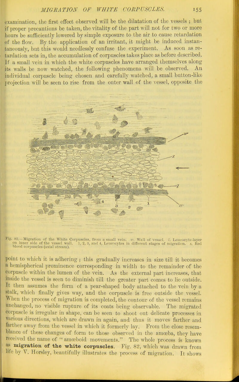 cxamiuation, the first cflFect observed will be the dilatation of the vessels ; but if proper precautious be takeu, the vitality of the part will not for two or more hours be sufBcieutly lowered by simple exposure to the air to cause retardation of the flow. By the application of an irritant, it might be induced instan- taneously, but this would needlessly confuse the experiment. As soon as re- tardation sets in, the accumulation of corpuscles takes place as before described. If a smaU A-ein in which the white corpuscles have arranged themselves along its walls be now watched, the following phenomena will be observed. An individual coi-puscle being chosen and carefully watched, a small button-like projection will be seen to rise from the outer wall of the vessel, opposite the l^ig. .sa. —llignitiou nf tlip AVliite Corpuscles, from !i .siiinll vein. ii\ Willi of vessel. J. Leueucyte-layer on inner side of the vessel wnll. 1, 2, S, aii<I 4, Leucocytes in different stages of migration. s. Red lildod corpuscles (axial stream). point to which it is adhering ; this gradually increases in size till it becomes a hemispherical prominence corresponding in width to the remainder of the corpuscle within the lumen of the vein. As the external part increases, that inside the vessel is seen to diminish till the greater part comes to lie outside. It then assumes the form of a pear-sha]3ed body attached to the vein by a stalk, which finally gives way, and the corpuscle is free outside the A-essel. When the process of migration is completed, the contour of the vessel remains unchanged, no visible rupture of its coats being observable. The migrated corpuscle is in-egular in shape, can be seen to shoot out delicate processes in various directions, which are drawn in again, and thus it moves ferther and farther away from the vessel in which it formerly lay. From the close resem- blance of these clianges of form to those observed in the amoeba, they have rcceiA^ed the name of  amojhoid movements. The whole process is known a« migration of the white corpuscles. Fig. 82, which was drawn from life by V. Horsley, beautifully ilhiHtrjitoR the profoss of migration. It shows