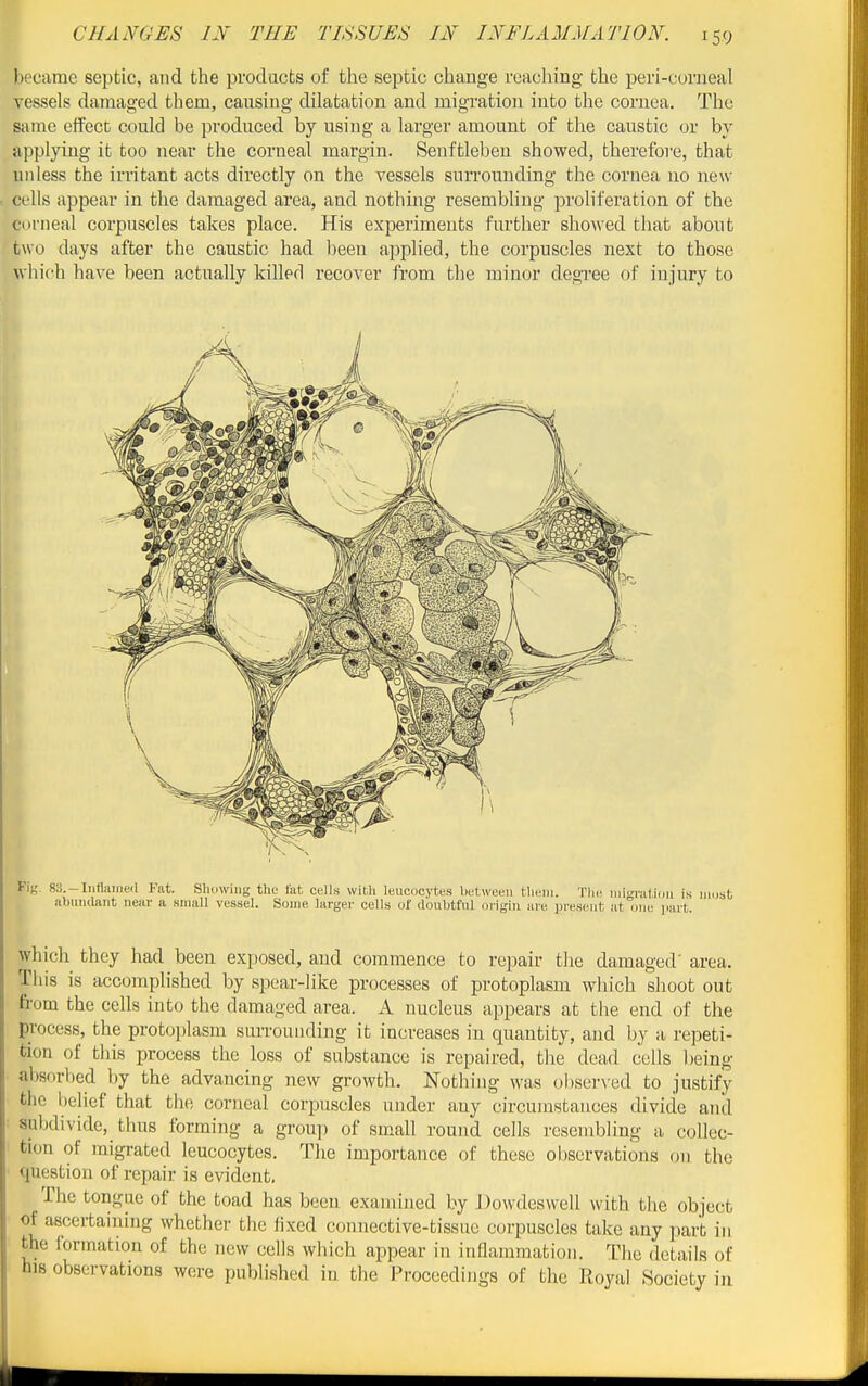 became septic, and the products of the septic change reaching the peri-corueal vessels damaged them, causing dilatation and migration into the cornea. The same effect could be produced by using a larger amount of the caustic or by applying it too near the corneal margin. Senftlebeu showed, therefore, that uidess the irritant acts directly on the vessels surrounding the cornea no new- cells appear in the damaged area, and nothing resembling proliferation of the corneal corpuscles takes place. His experiments further showed that about two days after the caustic had been applied, the corpuscles next to those which have been actually killer! recover from the minor degree of injury to which they had been exposed, and commence to repair the damaged' area. This is accomplished by spear-like processes of protoplasm which shoot out from the cells into the damaged area. A nucleus appears at the end of the process, the protoplasm surrounding it increases in quantity, and by a repeti- tion of tins process the loss of substance is repaired, the dead colls being al)sorl)ed by the advancing new growth. Nothing was obser\'ed to justify the beHef that the corneal corpuscles under any circumstances divide and subdivide, thus forming a group of small round cells resembling a collec- tion of migrated leucocytes. The importance of these observations on the question of repair is evident. The tongue of the toad has been examined by Dowdeswell with the object of ascertauiing whether the fixed connective-tissue corpuscles take any part in the formation of the new cells which appear in inflammation. The details of his observations were published in the Proceedings of the Royal Society in
