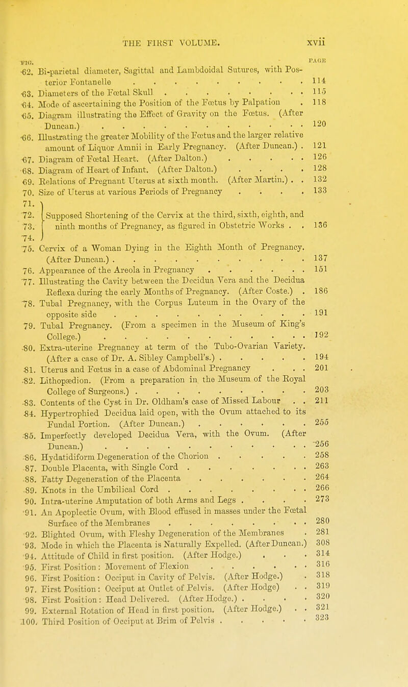 FIG. Supposed Shortening of the Cervix at the third, sixth, eighth, and ninth months of Pregnancy, as figured in Obstetric Works . . 136 PAGE •62. Bi-parietal diameter, Sagittal and Lamhdoidal Sutures, with Pos- terior Fontanelle 114 ■63. Diameters of the Foetal Skull 11.3 64. Mode of ascertaining the Position of the Foetus by Palpation . 118 65. Diagram illustrating the Effect of Gravity on the Foetus. (After Duncan.) • • • • • 120 66. Illustrating the greater Mobility of the Foetus and the larger relative amount of Liquor Amnii in Early Pregnancy. (After Duncan.) . 121 67. Diagram of Foetal Heart. (After Dal ton.) 126 •68. Diagram of Heart of Infant. (After Dalton.) . . 128 69. Relations of Pregnant Uterus at sixth month. (After Martin.) . . 132 70. Size of Uterus at various Periods of Pregnancy .... 133 71. 72. 73. 74. 75. Cervix of a Woman Dying in the Eighth Month of Pregnancy. (After Duncan.) 137 76. Appearance of the Areola in Pregnancy 151 77. Illustrating the Cavity between the Decidua Vera and the Decidua Eeflexa during the early Months of Pregnancy. (After Coste.) . 186 78. Tubal Pregnancy, with the Corpus Luteum in the Ovary of the opposite side .......... 191 79. Tubal Pregnancy. (From a specimen in the Museum of King's College.) • ■ • ... 192 ■80. Extra-uterine Pregnancy at term of the Tubo-Ovarian Variety. (After a case of Dr. A. Sibley Campbell's.) 194 81. Uterus and Foetus in a case of Abdominal Pregnancy . . . 201 ■82. Lithopsedion. (From a preparation in the Museum of the Royal College of Surgeons.) 203 ■83. Contents of the Cyst in Dr. Oldham's case of Missed Labour . . 211 84. Hypertrophied Decidua laid open, with the Ovum attached to its Fundal Portion. (After Duncan.) 255 ■85. Imperfectly developed Decidua Vera, with the Ovum. (After Duncan.) 256 86. Hydatidiform Degeneration of the Chorion 258 87. Double Placenta, -with Single Cord 263 ■ 88. Fatty Degeneration of the Placenta 264 89. Knots in the Umbilical Cord 266 DO. Intra-uterine Amputation of both Arms and Legs .... 273 •91. An Apoplectic Ovum, with Blood effused in masses under the Foetal Surface of the Membranes 280 •92. Blighted Ovum, with Fleshy Degeneration of the Membranes . 281 ■93. Mode in which the Placenta is Naturally Expelled. (After Duncan.) 308 91. Attitude of Child in first position. (After Hodge.) . . • 314 95. First Position: Movement of Flexion 316 96. First Position : Occiput in Cavity of Pelvis. (After Hodge.) . 318 97. First Position: Occiput at Outlet of Pelvis. (After Hodge) . . 319 98. First Position : Head Delivered. (After Hodge.) . . . • 320 v.). External Rotation of Head in first position. (After Hodge.) . . 321 J00. Third Position of Occiput at Brim of Pelvis 323