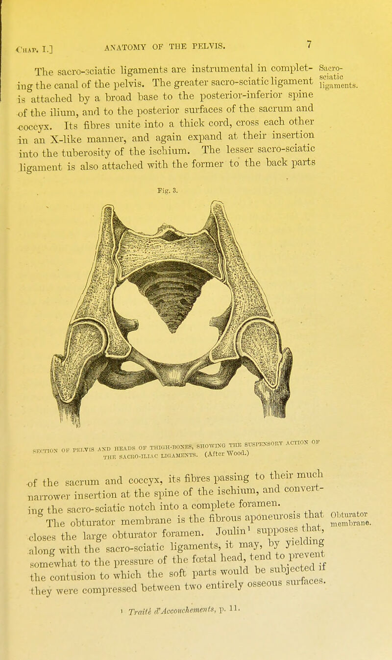 The sacro-sciatic ligaments are instrumental in complet- Sack- ing the canal of the pelvis. The greater sacro-sciatic ligament ifg^0ents> is attached by a broad base to the posterior-inferior spine of the ilium, and to the posterior surfaces of the sacrum and coccyx. Its fibres unite into a thick cord, cross each other in an X-like manner, and again expand at their insertion into the tuberosity of the ischium. The lesser sacro-sciatic ligament is also attached with the former to the back parts Fig. 3. THE SAOno-H-lAO LIQAKESSTS. (After Wood.) of the sacrum and coccyx, it, fibres passing to their much narrower insertion at the spine of the ischium, and convert- ing the sacro-sciatic notch into a complete foramen. gThe obturator membrane is the fibrous aponeuros.s hat obgj- closes the large obturator foramen. Joulin' along with the sacro-sciatic ligaments at may, by yiekhng somewhat to the pressure of the foetal head tend to prevent the contusion to which the soft parts would be subjectod f they were compressed between two entirely osseous surfaces.