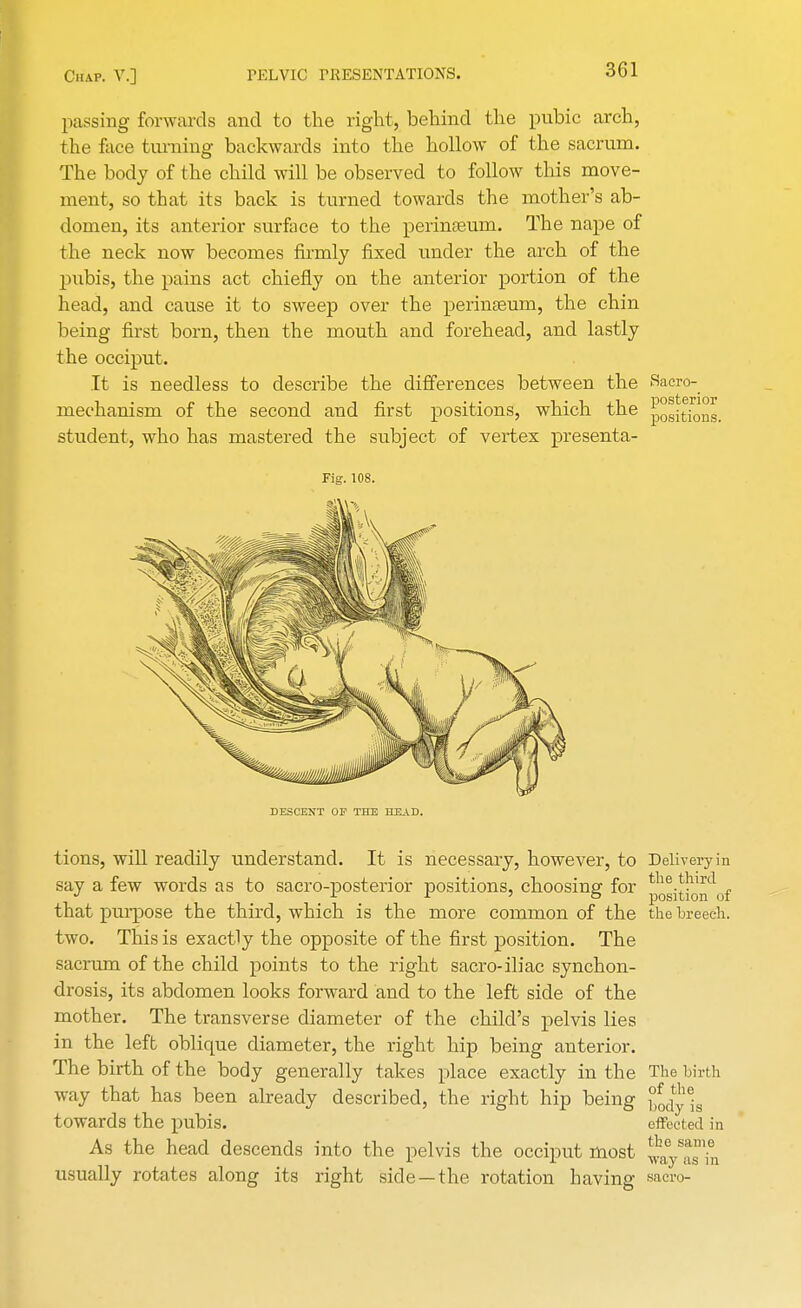 passing forwards and to the right, behind the pubic arch, the face turning backwards into the hollow of the sacrum. The body of the child will be observed to follow this move- ment, so that its back is turned towards the mother's ab- domen, its anterior surface to the perinseum. The nape of the neck now becomes firmly fixed under the arch of the pubis, the pains act chiefly on the anterior portion of the head, and cause it to sweep over the perinseum, the chin being first born, then the mouth and forehead, and lastly the occiput. It is needless to describe the differences between the Sacro- mechanism of the second and first positions, which the ^[^8. student, who has mastered the subject of vertex presenta- Fig. 108. DESCENT OP THE HEAD. tions, will readily understand. It is necessary, however, to Delivery in say a few words as to sacro-posterior positions, choosing for ^j^^of that purpose the third, which is the more common of the the breech, two. This is exactly the opposite of the first position. The sacrum of the child points to the right sacro-iliac synchon- drosis, its abdomen looks forward and to the left side of the mother. The transverse diameter of the child's pelvis lies in the left oblique diameter, the right hip being anterior. The birth of the body generally takes place exactly in the The birth way that has been already described, the right hip being body is towards the pubis. effected in As the head descends into the pelvis the occiput most ^JHd. usually rotates along its right side—the rotation having saero-