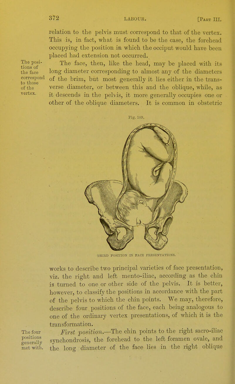 The posi- tions of the face correspond to those of the vertex. relation to the pelvis must correspond to that of the vert This is, in fact, what is found to be the case, the forehead occupying the position in which the occiput would have been placed had extension not occurred. The face, then, like the head, may be placed with its long diameter corresponding to almost any of the diameters of the brim, but most generally it lies either in the trans- verse diameter, or between this and the oblique, while, as it descends in the pelvis, it more generally occupies one or other of the oblique diameters. It is common in obstetric Pig. 109. THIRD POSITION IX FACE PRESENTATIONS. works to describe two principal varieties of face presentation, viz. the right and left mento-iliac, according as the chin is turned to one or other side of the pelvis. It is better, however, to classify the positions in accordance with the part of the pelvis to which the chin points. We may, therefore, describe four positions of the face, each being analogous to one of the ordinary vertex presentations, of which it is the tran sformation. The four First 'position.—The chin points to the right sacro-iliac fenSafly synchondrosis, the forehead to the left foramen ovale, and met with, the long diameter of the face lies in the right oblique