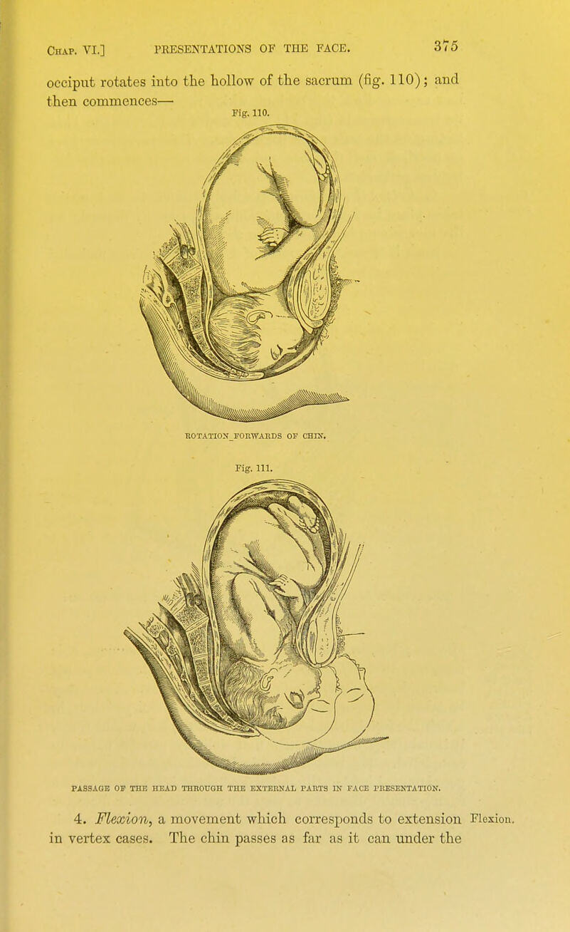 occiput rotates into the hollow of the sacrum (fig. 110); and then commences— Fig. no. ROTATION FORWARDS OF CHIN. Fig. 111. PASSAGE OF THE HEAD THROUGH THE EXTERNAL PARTS IN FACE PRESENTATION. 4. Flexion, a movement which corresponds to extension Flexion, in vertex cases. The chin passes as far as it can under the