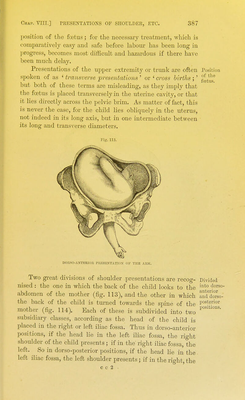 position of the fetus; for the necessary treatment, which is comparatively easy and safe before labour has been long in progress, becomes most difficult and hazardous if there have been much delay. Presentations of the upper extremity or trunk are often Position spoken of as ' transverse presentations ' or ' cross births ;' j?^e but both of these terms are misleading, as they imply that the foetus is placed transversely in the uterine cavity, or that it lies directly across the pelvic brim. As matter of fact, this is never the case, for the child lies obliquely in the uterus, not indeed in its long axis, but in one intermediate between its long and transverse diameters. Fig. 113. DOr.SO-ANTERIOK PRESENTATION OF THE ABM. Two great divisions of shoulder presentations are recog- Divided nised : the one in which the back of the child looks to the into 4ors°- abdomen of the mother (fig. 113), and the other in which anddorso- the back of the child is turned towards the spine of the Pos!£.rior mother (fig. 114). Each of these is subdivided into two P°Sltl°nS* subsidiary classes, according as the head of the child is placed in the right or left iliac fossa. Thus in dorso-anterior positions, if the head lie in the left iliac fossa, the right shoulder of the child presents; if in the' right iliac fossa, the left. So in dorso-posterior positions, if the head lie in the left iliac fossa, the left shoulder presents; if in the right, the